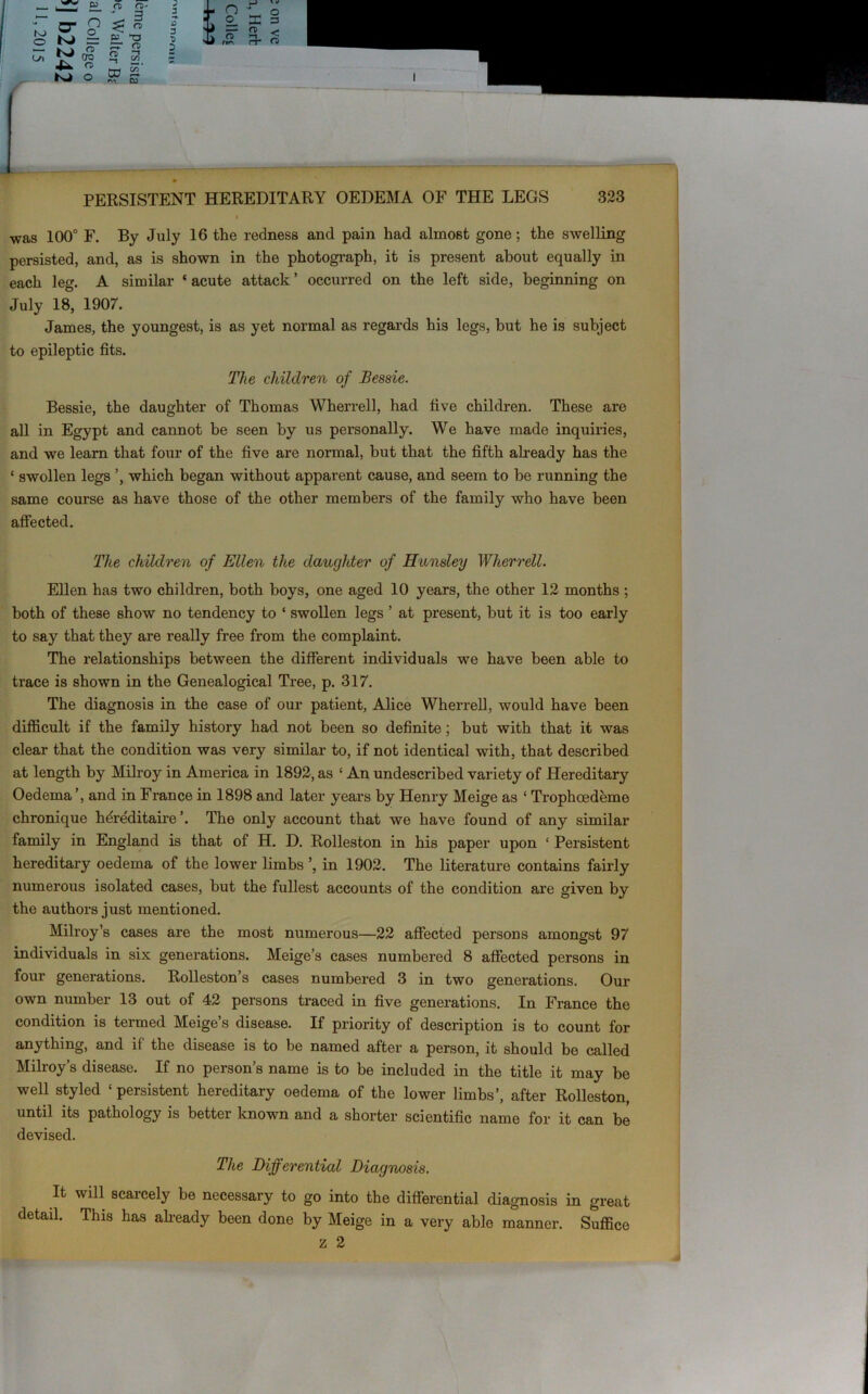 t was 100° F. By July 16 the redness and pain had almost gone; the swelling persisted, and, as is shown in the photograph, it is present about equally in each leg. A similar ‘ acute attack ’ occurred on the left side, beginning on July 18, 1907. James, the youngest, is as yet normal as regards his legs, but he is subject to epileptic fits. The children of Bessie. Bessie, the daughter of Thomas Wherrell, had five children. These are all in Egypt and cannot be seen by us personally. We have made inquiries, and we learn that four of the five are normal, hut that the fifth already has the ‘ swollen legs ’, which began without apparent cause, and seem to he running the same course as have those of the other members of the family who have been affected. The children of Ellen the daughter of Hunsley Wherrell. Ellen has two children, both boys, one aged 10 years, the other 12 months ; both of these show no tendency to ‘ swollen legs ’ at present, but it is too early to say that they are really free from the complaint. The relationships between the different individuals we have been able to trace is shown in the Genealogical Tree, p. 317. The diagnosis in the case of our patient, Alice Wherrell, would have been difficult if the family history had not been so definite; but with that it was clear that the condition was very similar to, if not identical with, that described at length by Milroy in America in 1892, as ‘ An undescribed variety of Hereditary Oedema ’, and in France in 1898 and later years by Henry Meige as ‘ Trophoedeme chronique hdreditaire ’. The only account that we have found of any similar family in England is that of H. D. Rolleston in his paper upon ‘ Persistent hereditary oedema of the lower limbs ’, in 1902. The literature contains fairly numerous isolated cases, but the fullest accounts of the condition are given by the authors just mentioned. Milroy’s cases are the most numerous—22 affected persons amongst 97 individuals in six generations. Meige’s cases numbered 8 affected persons in four generations. Rolleston’s cases numbered 3 in two generations. Our own number 13 out of 42 persons traced in five generations. In France the condition is termed Meige’s disease. If priority of description is to count for anything, and if the disease is to be named after a person, it should be called Milroy’s disease. If no person’s name is to be included in the title it may be well styled ‘ persistent hereditary oedema of the lower limbs’, after Rolleston, until its pathology is better known and a shorter scientific name for it can be devised. The Differential Diagnosis. It will scarcely be necessary to go into the differential diagnosis in great detail. This has already been done by Meige in a very able manner. Suffice z 2