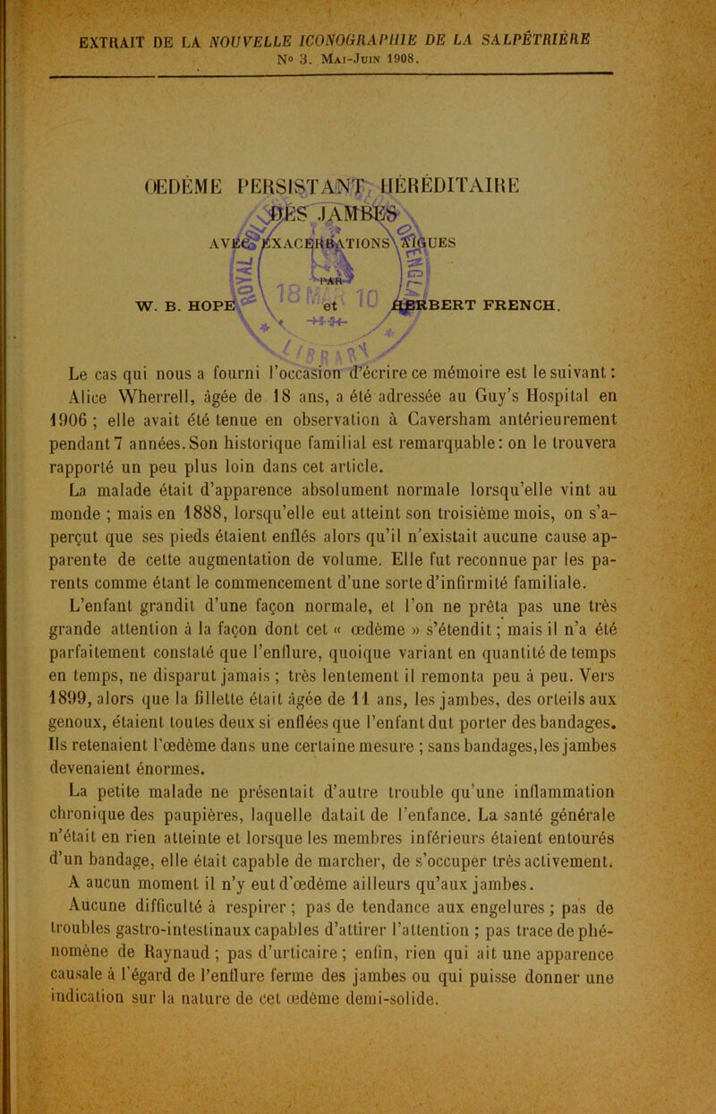 N° 3. Mai-Juin 1908. OEDÈME PERSISTANT HÉRÉDITAIRE W. B. HOPE BERT FRENCH. Le cas qui nous a fourni l’occasion d’écrire ce mémoire est le suivant: Alice Wherrell, âgée de 18 ans, a été adressée au Guy’s Hospital en 1906; elle avait été tenue en observation à Caversham antérieurement pendant7 années.Son historique familial est remarquable: on le trouvera rapporté un peu plus loin dans cet article. La malade était d’apparence absolument normale lorsqu’elle vint au monde ; mais en 1888, lorsqu’elle eut atteint son troisième mois, on s’a- perçut que ses pieds étaient enflés alors qu’il n’existait aucune cause ap- parente de cette augmentation de volume. Elle fut reconnue par les pa- rents comme étant le commencement d’une sorte d’infirmité familiale. L’enfant grandit d’une façon normale, et l’on ne prêta pas une très grande attention à la façon dont cet « œdème » s’étendit ; mais il n’a été parfaitement constaté que l’enflure, quoique variant en quantité de temps en temps, ne disparut jamais ; très lentement il remonta peu à peu. Vers 1899, alors que la fillette était âgée de 11 ans, les jambes, des orteils aux genoux, étaient toutes deux si enflées que l’enfant dut porter des bandages. Ils retenaient l’œdème dans une certaine mesure ; sans bandages, les jambes devenaient énormes. La petite malade ne présentait d’autre trouble qu’une inflammation chronique des paupières, laquelle datait de l’enfance. La santé générale n’était en rien atteinte et lorsque les membres inférieurs étaient entourés d’un bandage, elle était capable de marcher, de s’occuper très activement, A aucun moment il n’y eut d’œdème ailleurs qu’aux jambes. Aucune difficulté à respirer; pas de tendance aux engelures ; pas de troubles gastro-intestinaux capables d’attirer l’attention ; pas trace de phé- nomène de Raynaud; pas d’urticaire; enfin, rien qui ait une apparence causale à l’égard de l’enflure ferme des jambes ou qui puisse donner une indication sur la nature de cet œdème demi-solide.