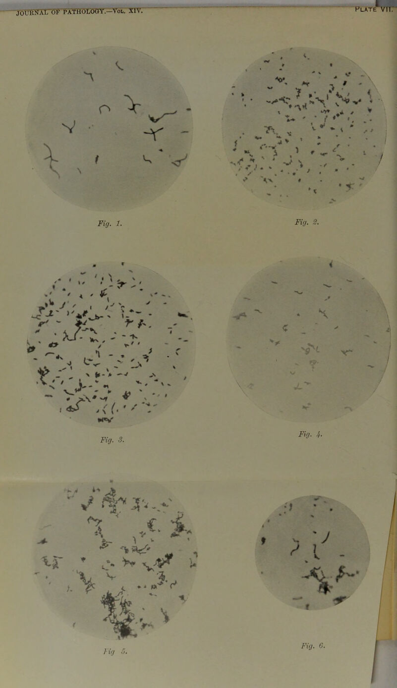 Plate m* JOURNAL OF PATHOLOGY.—VOL. XiV. ■v Fig. 1. Fig. 2. Fig. 6.