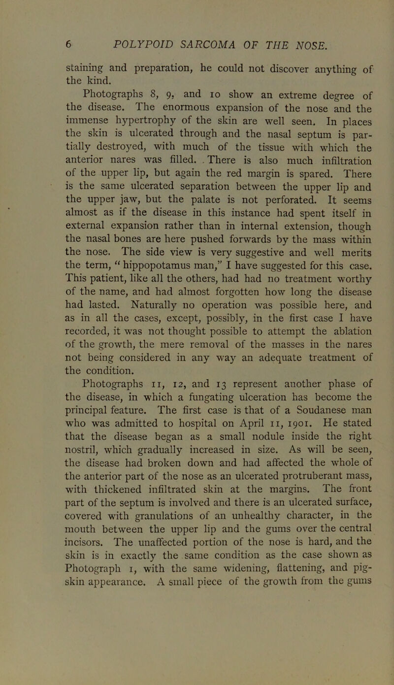 staining and preparation, he could not discover anything of the kind. Photographs 8, 9. and 10 show an extreme degree of the disease. The enormous expansion of the nose and the immense hypertrophy of the skin are well seen. In places the skin is ulcerated through and the nasal septum is par- tially destroyed, with much of the tissue with which the anterior nares was filled. There is also much infiltration of the upper lip, but again the red margin is spared. There is the same ulcerated separation between the upper lip and the upper jaw, but the palate is not perforated. It seems almost as if the disease in this instance had spent itself in external expansion rather than in internal extension, though the nasal bones are here pushed forwards by the mass within the nose. The side view is very suggestive and well merits the term, “ hippopotamus man,” I have suggested for this case. This patient, like all the others, had had no treatment worthy of the name, and had almost forgotten how long the disease had lasted. Naturally no operation was possible here, and as in all the cases, except, possibly, in the first case I have recorded, it was not thought possible to attempt the ablation of the growth, the mere removal of the masses in the nares not being considered in any way an adequate treatment of the condition. Photographs n, 12, and 13 represent another phase of the disease, in which a fungating ulceration has become the principal feature. The first case is that of a Soudanese man who was admitted to hospital on April 11, 1901. He stated that the disease began as a small nodule inside the right nostril, which gradually increased in size. As will be seen, the disease had broken down and had affected the whole of the anterior part of the nose as an ulcerated protruberant mass, with thickened infiltrated skin at the margins. The front part of the septum is involved and there is an ulcerated surface, covered with granulations of an unhealthy character, in the mouth between the upper lip and the gums over the central incisors. The unaffected portion of the nose is hard, and the skin is in exactly the same condition as the case shown as Photograph 1, with the same widening, flattening, and pig- skin appearance. A small piece of the growth from the gums