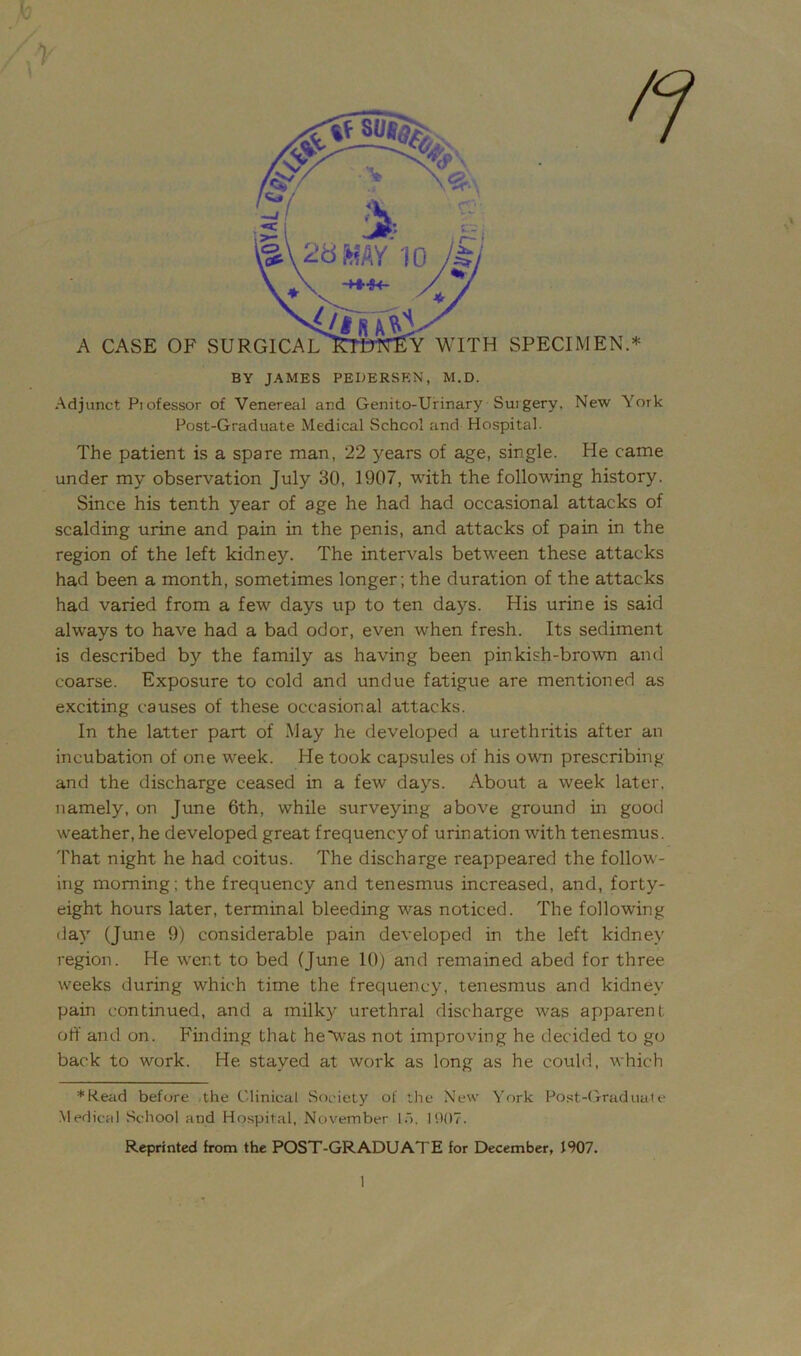 BY JAMES PEDERSEN, M.D. Adjunct Piofessor of Venereal and Genito-Urinary Suigery, New York Post-Graduate Medical School and Hospital. The patient is a spare man, 22 years of age, single. He came under my observation July 30, 1907, with the following history. Since his tenth year of age he had had occasional attacks of scalding urine and pain in the penis, and attacks of pain in the region of the left kidney. The intervals between these attacks had been a month, sometimes longer ; the duration of the attacks had varied from a few days up to ten days. His urine is said always to have had a bad odor, even when fresh. Its sediment is described by the family as having been pinkish-brown and coarse. Exposure to cold and undue fatigue are mentioned as exciting causes of these occasional attacks. In the latter part of May he developed a urethritis after an incubation of one week. He took capsules of his own prescribing and the discharge ceased in a few days. About a week later, namely, on June 6th, while surveying above ground in good weather, he developed great frequency of urination with tenesmus. That night he had coitus. The discharge reappeared the follow- ing morning: the frequency and tenesmus increased, and, forty- eight hours later, terminal bleeding was noticed. The following day (June 9) considerable pain developed in the left kidney region. He went to bed (June 10) and remained abed for three weeks during which time the frequency, tenesmus and kidney pain continued, and a milky urethral discharge was apparent off and on. Finding that he*was not improving he decided to go back to work. He stayed at work as long as he could, which *Kead before the Clinical Society of the New York Post-Graduale Medical School and Hospital, November la. I DOT. Reprinted from the POST-GRADUATE for December, 1907. 1