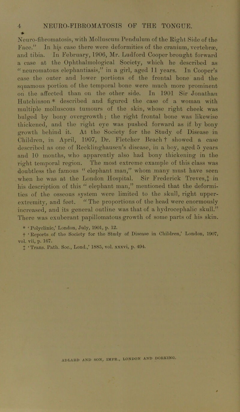 ♦ Neuro-fibromatosis, with Molluscmn Pendulum of the Right Side of the Face.” In his case there were deformities of the cranium, vertebrae, and tibia. In February, 1906, Mr. Ludford Cooper brought forward a case at the Ophtlialmological Society, which he described as “ neuromatous elephantiasis,” in a girl, aged 11 years. In Cooper’s case the outer and lower portions of the frontal bone and the squamous portion of the temporal bone were much more prominent on the affected than on the other side. In 1901 Sir Jonathan Hutchinson * described and figured the case of a woman with multiple molluscous tumours of the skin, whose right cheek was bulged by bony overgrowth ; the right frontal bone was likewise thickened, and the right eye was pushed forward as if by bony growth behind it. At the Society for the Study of Disease in Children, in April, 1907, Dr. Fletcher Beach t showed a case described as one of Recklinghausen’s disease, in a boy, aged 5 years and 10 months, who apparently also had bony thickening in the right temporal region. The most extreme example of this class was doubtless the famous “ elephant man,” whom many must have seen when he was at the London Hospital. Sir Frederick Treves,£ in his description of this “ elephant man,” mentioned that the deformi- ties of the osseous system were limited to the skull, right upper- extremity, and feet. “The proportions of the head were enormously increased, and its general outline was that of a hydrocephalic skull.” There was exuberant papillomatous growth of some parts of his skin. * 'Polyclinic/ London, July, 1901, p. 12. t 'Reports of tlie Society for the Study of Disease in Children/ London, 1907, vol. vii, p. 167. X 'Trans. Path. Soc., Lond./ 1885, vol. xxxvi, p. 494. ADLARD AND SON, IMPR., LONDON AND DORKING.