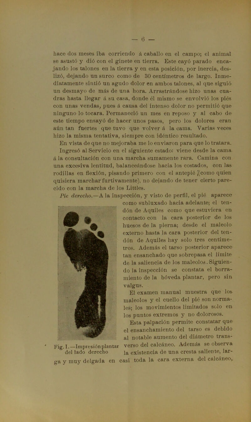 hace dos meses iba corriendo á caballo en el campo; el animal se asustó y dió con el ginete en tierra. Este cayó parado enca- jando los talones en la tierra y en esta posición, por inercia, des- lizó, dejando un surco como de 80 centímetros de largo. Inme- diatamente sintió un agudo dolor en ambos talones, al que siguió un desmayo de más de una hora. Arrastrándose hizo unas cua- dras hasta llegar á su casa, donde él mismo se envolvió los piés con unas vendas, pues á causa del intenso dolor no permitió que ninguno lo tocara. Permaneció un mes en reposo y al cabo de este tiempo ensayó de hacer unos pasos, pero los dolores eran aún tan fuertes que tuvo que volver á la cama. Varias veces hizo la misma tentativa, siempre con idéntico resultado. En vista de que no mejoraba me lo enviaron para que lo tratara. Ingresó al Servicio en el siguiente estado: viene desde la cama á la consultación con una marcha sumamente rara. Camina con una excesiva lentitud, balanceándose hacia los costados, con las rodillas en flexión, pisando primero con el antepié ¡(como quien quisiera marchar furtivamente), no dejando de tener cierto pare- cido con la marcha de los Littles. Pie derecho.—A la inspección, y visto de perfil, el pié aparece como subluxado hacia adelante; el ten- dón de Aquiles como que estuviera en contacto con la cara posterior de los huesos de la pierna; desde el maléolo externo hasta la cara posterior del ten- dón de Aquiles hay solo tres centíme- tros. Además el tarso posterior aparece- tan ensanchado que sobrepasa el límite de la saliencia de los maléolos. Siguien- do la inspección se constata el borra- miento de la bóveda plantar, pero sin valgus. El examen manual muestra que los maléolos y el cuello del pié son norma- les; los movimientos limitados solo en los puntos extremos y no dolorosos. Esta palpación permite constatar que el ensanchamiento del tarso es debido al notable aumento del diámetro trans- verso del calcáneo. Además se observa la existencia de una cresta saliente, lar- Fig. I. —Impresión plantar del lado derecho ga y muy delgada en casi toda la cara externa del calcáneo,.