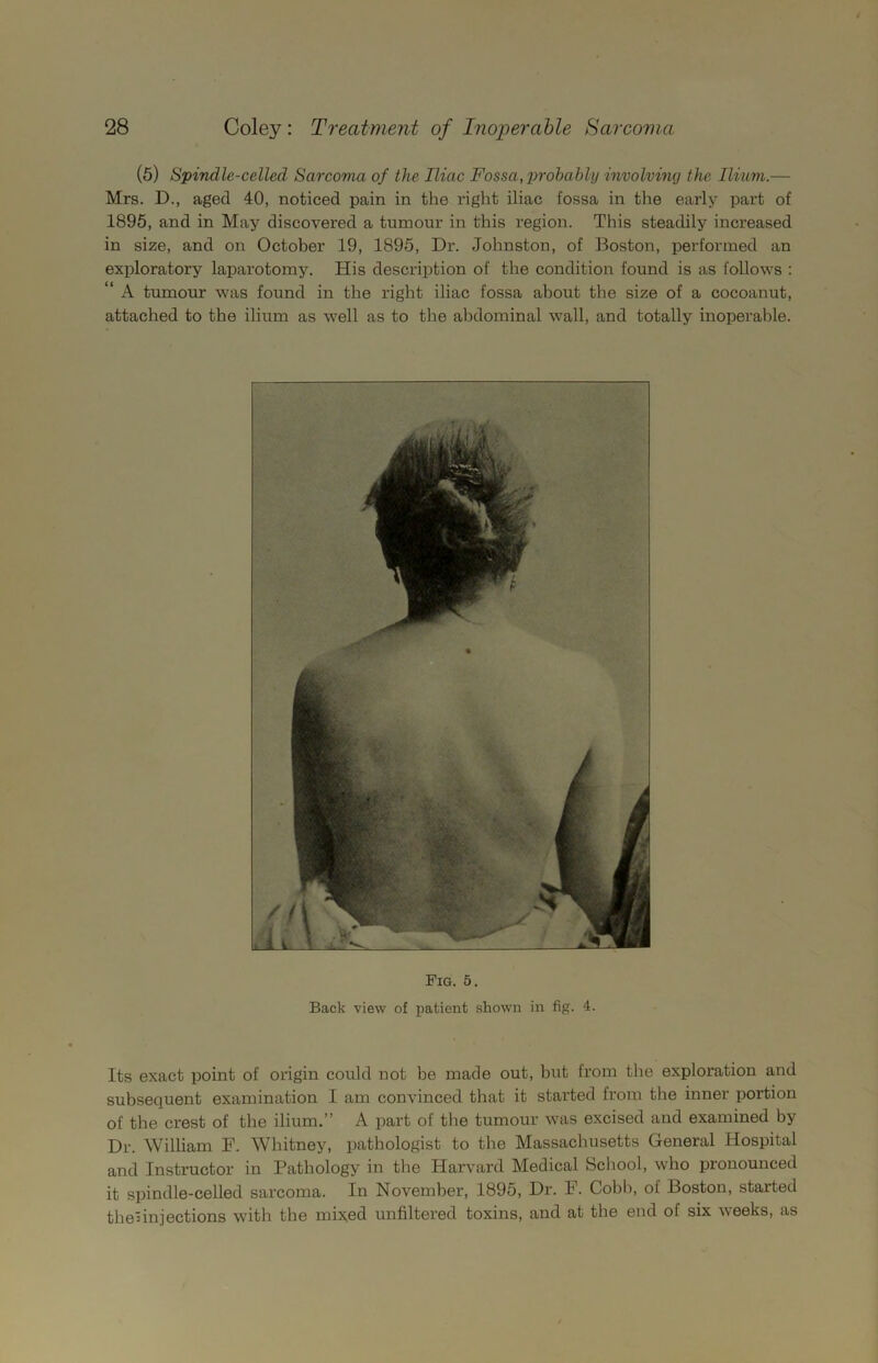 (5) Spindle-celled Sarcoma of the Iliac Fossa, probably involving the Ilium.— Mrs. D., aged 40, noticed pain in the right iliac fossa in the early part of 1895, and in May discovered a tumour in this region. This steadily increased in size, and on October 19, 1895, Dr. Johnston, of Boston, performed an exploratory laparotomy. His description of the condition found is as follows : “ A tumour was found in the right iliac fossa about the size of a cocoanut, attached to the ilium as well as to the abdominal wall, and totally inoperable. Fig. 5. Back view of patient shown in fig. 4. Its exact point of origin could not be made out, but from the exploration and subsequent examination I am convinced that it started from the inner portion of the crest of the ilium.” A part of the tumour was excised and examined by Dr. William F. Whitney, pathologist to the Massachusetts General Hospital and Instructor in Pathology in the Harvard Medical School, who pronounced it spindle-celled sarcoma. In November, 1895, Dr. F. Cobh, of Boston, started the:injections with the mixed unfiltered toxins, and at the end of six weeks, as