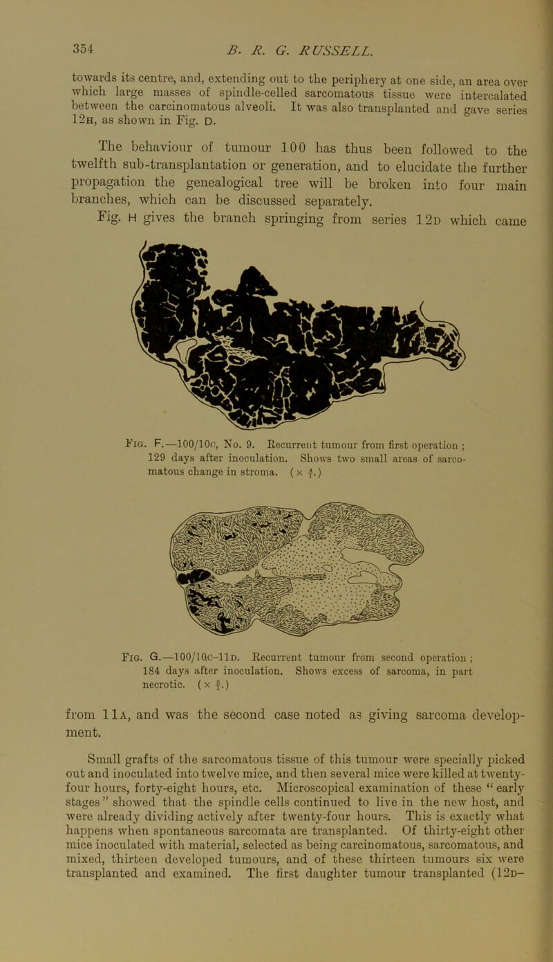 towards its centre, and, extending out to the periphery at one side, an area over which large masses of spindle-celled sarcomatous tissue were intercalated between the carcinomatous alveoli. It was also transplanted and gave series 12h, as shown in Fig. D. The behaviour of tumour 100 has thus been followed to the twelfth sub-transplantation or generation, and to elucidate the further propagation the genealogical tree will be broken into four main branches, which can be discussed separately. Fig. H gives the branch springing from series 12d which came Fig. F.—lOO/lOc, No. 9. Recurrent tumour from first operation ; 129 days after inoculation. Shows two small areas of sarco- matous change in stroma. ( x -}.) Fig. G.—100/1Qc-11d. Recurrent tumour from second operation ; 184 days after inoculation. Shows excess of sarcoma, in part necrotic. ( x ^.) from 11a, and was the second case noted as giving sarcoma develop- ment. Small grafts of the sarcomatous tissue of this tumour were specially picked out and inoculated into twelve mice, and then several mice were killed at twenty- four hours, forty-eight hours, etc. Microscopical examination of these “ early stages ” showed that the spindle cells continued to live in the new host, and were already dividing actively after twenty-four hours. This is exactly what happens when spontaneous sarcomata are transplanted. Of thirty-eight other mice inoculated with material, selected as being carcinomatous, sarcomatous, and mixed, thirteen developed tumours, and of these thirteen tumours six were transplanted and examined. The first daughter tumour transplanted (12d-