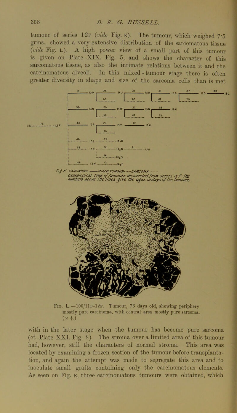 tumour of series 12f {vide Fig. k). The tumour, which weighed 7‘5 grms., showed a very extensive distribution of the sarcomatous tissue {vide Fig. L). A higli power view of a small part of this tumour is given on Plate XIX. Fig. 5, and shows the character of this sarcomatous tissue, as also the intimate relations between it and the carcinomatous alveoli. In this mixed - tumour stage there is often greater diversity in shape and size of the sarcoma cells than is met IIB 76 • I2F c > I3N 20 22 1 69 €7 21 22 39 — 14,0 22 21 ' 64 —l4iC , fSN , I5Q C ■I6C i IJW CARCINOMA M/X£0 TUMOUR SARCOMA - Genea/o^/ca/ tree of tumours c/escended from senes /2 f tfye numbers above toe //nes ^ive the a£es todays of the tumours. Fig. L.—100/11b-12f. Tumour, 76 days old, showing periphery mostly pure carcinoma, with central area mostly pure sarcoma. (X f) with in the later stage when the tumour has become pure sarcoma (cf. Plate XXL Fig. 8). The stroma over a limited area of this tumour had, however, still the characters of normal stroma. This area was located by examining a frozen section of the tumour before transplanta- tion, and again the attempt was made to segregate this area and to inoculate small grafts containing only the carcinomatous elements. As seen on Fig. k, three carcinomatous tumours were obtained, which