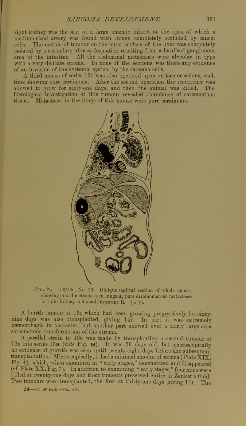 right kidney was the seat of a large anaemic infarct at the apex of which a medium-sized artery was found with lumen completely occluded by cancer cells. The nodule of tumour on the outer surface of the liver was completely isolated by a secondary abscess formation resulting from a localised gangrenous area of the intestine. All the abdominal metastases were alveolar in type with a very delicate stroma. In none of the sections was there any evidence of an invasion of the systemic system by the sarcoma cells. A third mouse of series 13o was also operated upon on two occasions, each time showing pure carcinoma. After the second operation the recurrence was allowed to grow for sixty-one days, and then the animal was killed. The histological investigation of this tumour revealed abundance of sarcomatous tissue. Metastases in the lungs of this mouse were pure carcinoma. Fig. N.—100/13C, No. 10. Oblique sagittal section of whole mouse, showing mixed metastases in lungs A, pure carcinomatous metastases in right kidney and small intestine B. ( x f). A fourth tumour of 13c which had been growing progressively for sixty- nine days was also transplanted, giving 14p. In part it was extremely haemorrhagic in character, but another part showed over a fairly large area sarcomatous transformation of the stroma. A parallel strain to 13c was made by transplanting a second tumour of 12b into series 13h {vide Fig. m). It was 56 days old, but macroscopically no evidence of growth was seen until twenty- eight days before the subsequent transplantation. Microscopically, it had a minimal amount of stroma (Plate XIX. Fig. 4), which, when examined in “ early stages,” degenerated and disappeared (cf. Plate XX. Fig. 7). In addition to examining “ early stages,” four mice were killed at twenty-one days and their tumours preserved entire in Zenker’s fluid. Two tumours were transplanted, the first at thirty-one days giving 14i. The 24 JL. OF PATH.—VOL. XIV.