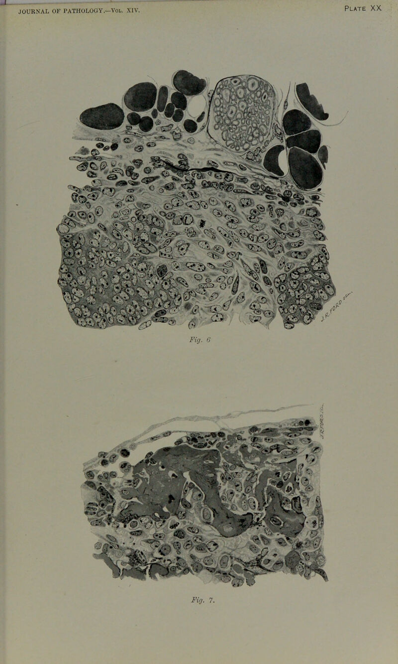 J JOURNAL OF PATHOLOGY.—VOL. XIV. Plate XX Fig. G ^ s':