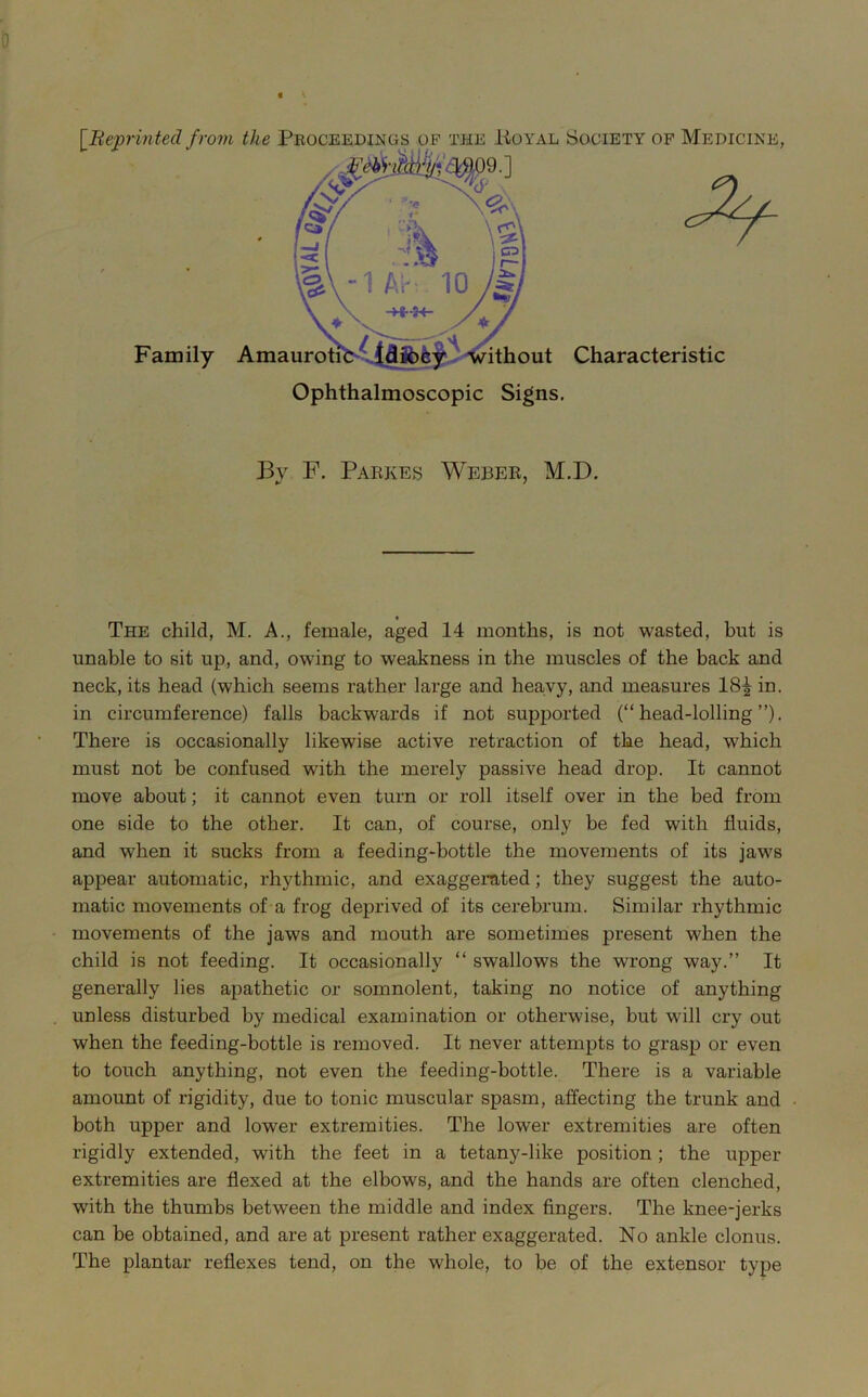 [^Beprinted from the Proceedings of the Koyal •] Family ithout Characteristic Ophthalmoscopic Signs. Society of Medicine, By F. Pabkes Webee, M.D. The child, M. A., female, aged 14 months, is not wasted, but is unable to sit up, and, owing to weakness in the muscles of the back and neck, its head (which seems rather large and heavy, and measures 18^ in. in circumference) falls backwards if not supported (“head-lolling”). There is occasionally likewise active retraction of the head, which must not be confused with the merely passive head drop. It cannot move about; it cannot even turn or roll itself over in the bed from one side to the other. It can, of course, only be fed with fluids, and when it sucks from a feeding-bottle the movements of its jaws appear automatic, rhythmic, and exaggerated; they suggest the auto- matic movements of a frog deprived of its cerebrum. Similar rhythmic movements of the jaws and mouth are sometimes present when the child is not feeding. It occasionally “ swallows the wrong way.” It generally lies apathetic or somnolent, taking no notice of anything unless disturbed by medical examination or otherwise, but will cry out when the feeding-bottle is removed. It never attempts to grasp or even to touch anything, not even the feeding-bottle. There is a variable amount of rigidity, due to tonic muscular spasm, affecting the trunk and both upper and lower extremities. The lower extremities are often rigidly extended, with the feet in a tetany-like position; the upper extremities are flexed at the elbows, and the hands are often clenched, with the thumbs between the middle and index fingers. The knee-jerks can be obtained, and are at present rather exaggerated. No ankle clonus. The plantar reflexes tend, on the whole, to be of the extensor type