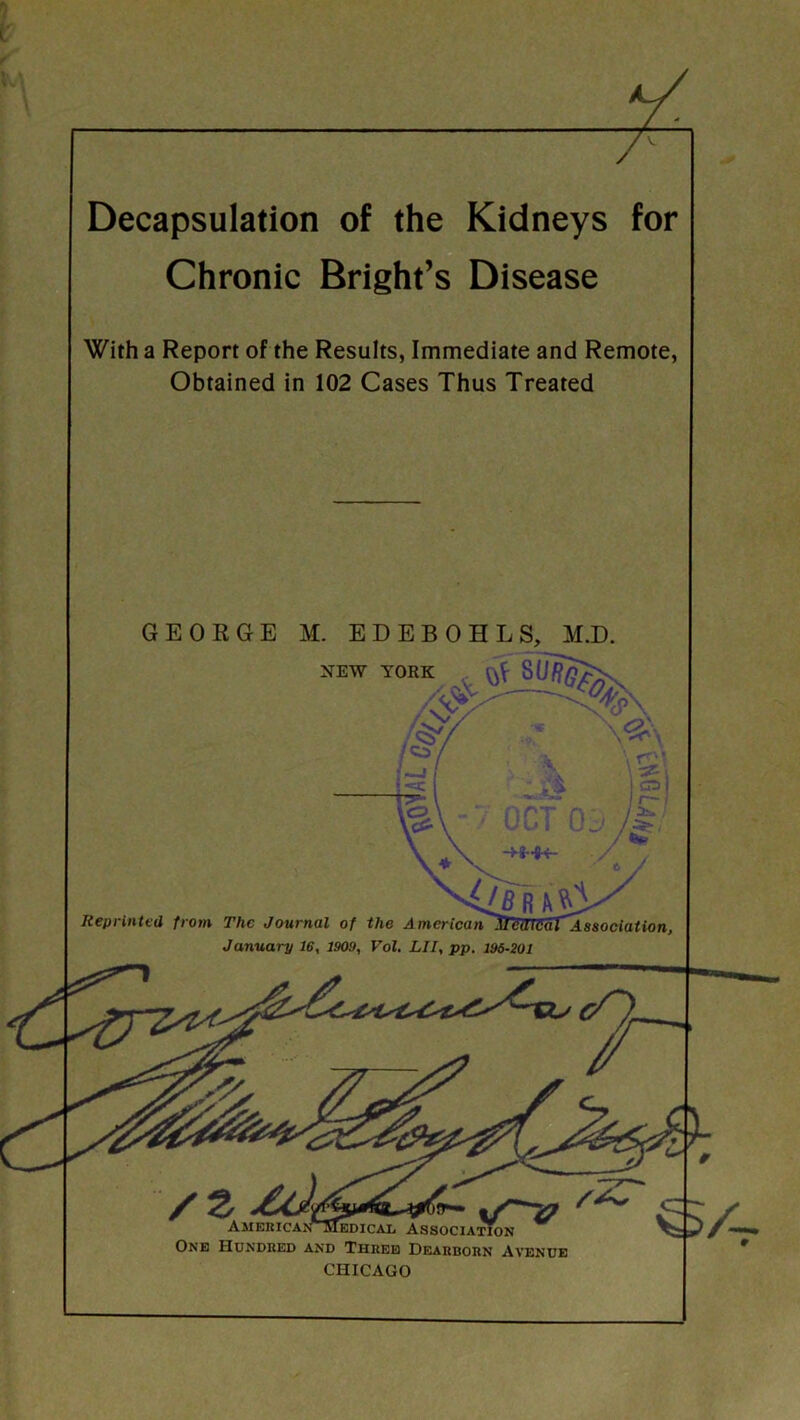 Decapsulation of the Kidneys for Chronic Bright’s Disease With a Report of the Results, Immediate and Remote, Obtained in 102 Cases Thus Treated GEORGE M. EDEBOHLS, M.D. NEW YORK \ rr Reprinted from The Journal of the n> January 16, 1909, Vol. LI I, pp. 196-201 One Hundred and Three Dearborn Avenue CHICAGO