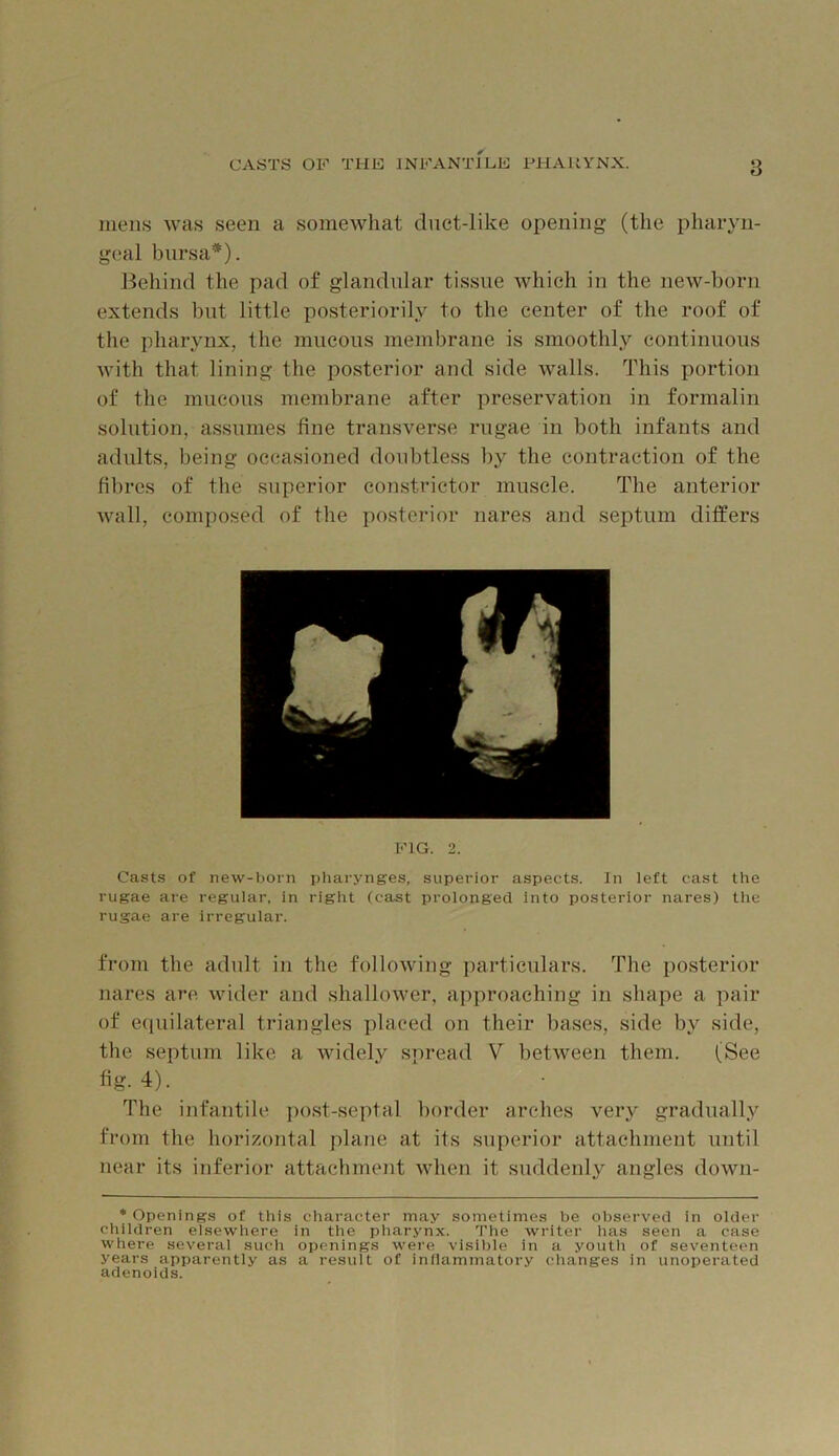 mens was seen a somewhat duct-like opening (the pharyn- geal bursa*). Behind the pad of glandular tissue which in the new-born extends but little posteriorily to tbe center of the roof of the pharynx, the mucous membrane is smoothly continuous with that lining the posterior and side walls. This portion of the mucous membrane after preservation in formalin solution, assumes fine transverse rugae in both infants and adults, being occasioned doubtless l)y the contraction of the fibres of the superior constrictor muscle. The anterior wall, composed of the posterior nares and septum differs FIG. 2. Casts of new-born pharynges, superior aspects. In left cast the rugae are regular, in right (cast prolonged into posterior nares) tlie rugae are irregular. from the adult in the following particulars. The posterior nares are wider and shallower, approaching in shape a pair of equilateral triangles placed on their bases, side by side, the septum like a widely spread V between them. (See fig. 4). The infantile post-septal border arches very gradually from the horizontal plane at its superior attachment until near its inferior attachment when it suddenly angles down- * Openings of this character may sometimes be observed in older children elsewhere in the pharynx. The writer has seen a case where several sucli openings were visilile in a youtli of seventeen years apparently as a result of inllammatory changes in unoperated adenoids.