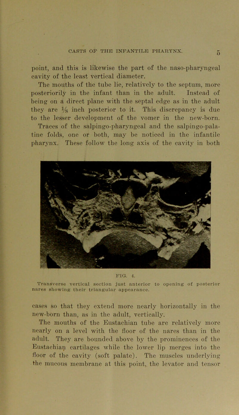 point, and this is likewise the part of the naso-pharyngeal cavity of the least vertical diameter. The months of the tube lie, relatively to the septum, more posteriorily in the infant than in the adult. Instead of being on a direct plane with the septal edge as in the adult they are % inch posterior to it. This discrepancy is due to the lesser development of the vomer in the new-born. Traces of the salpingo-pharyngeal and the salpingo-pala- tine folds, one or both, may be noticed in the infantile phai’ynx. These follow the long axis of the cavity in both FIG. 4. Transverse vertical section just anterior to opening of posterior nares showing their triangular appearance. cases SO that they extend more nearly horizontally in the new-born than, as in the adult, vertically. The mouths of the Eustachian tube are relatively more nearly on a level with the floor of the nares than in the adult. They are bounded above by the prominences of the Eustachian cartilages while the lower lip merges into the floor of the cavity (soft palate). The muscles underlying the mucous membrane at this point, the levator and tensor