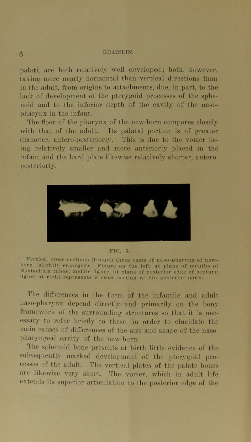 G palati, are both relatively Avell developed; both, however, taking more nearly horizontal than vertical directions than in the adnlt, from origins to attachments, dne, in part, to the lack of development of the pterygoid processes of the sphe- noid and to the inferior depth of the cavity of the naso- pharynx in the infant. The door of the pharynx of the new-born compares closely with that of the adnlt. Its palatal portion is of greater diameter, antero-posteriorly. This is dne to the vomer be- ing relatively smaller and more anteriorl.y placed in the infant and the hard i)late likeAvise relatively shorter, antero- jiosteriorly. 44 FIG. 5. Vei'tical cross-sections tlirougli three casts of naso-pharynx of new- born (slightly enlarged). Figure on the left, at plane of mouths of Eustachian tubes; middle figure, at plane of posterior edge of septum; figure at right represents a cross-section within posterior nares. The differences in the form of the infantile and adult naso-jiharynx depend directly' and primaril}' on the bony framework of the surrounding .structures so that it is nec- essary to refer briefly to these, in order to elucidate the main causes of differences of the size and shape of the naso- pharyngeal cavity of the new-born. The sphenoid bone presents at birth little evidence of the siibsefiuently marked development of the ])terygoid pro- ces.ses of the adult. The vertical jilates of the palate bones are likewise very short. The vomer, which in adult life extends its superior articulation to the posterior edge of the