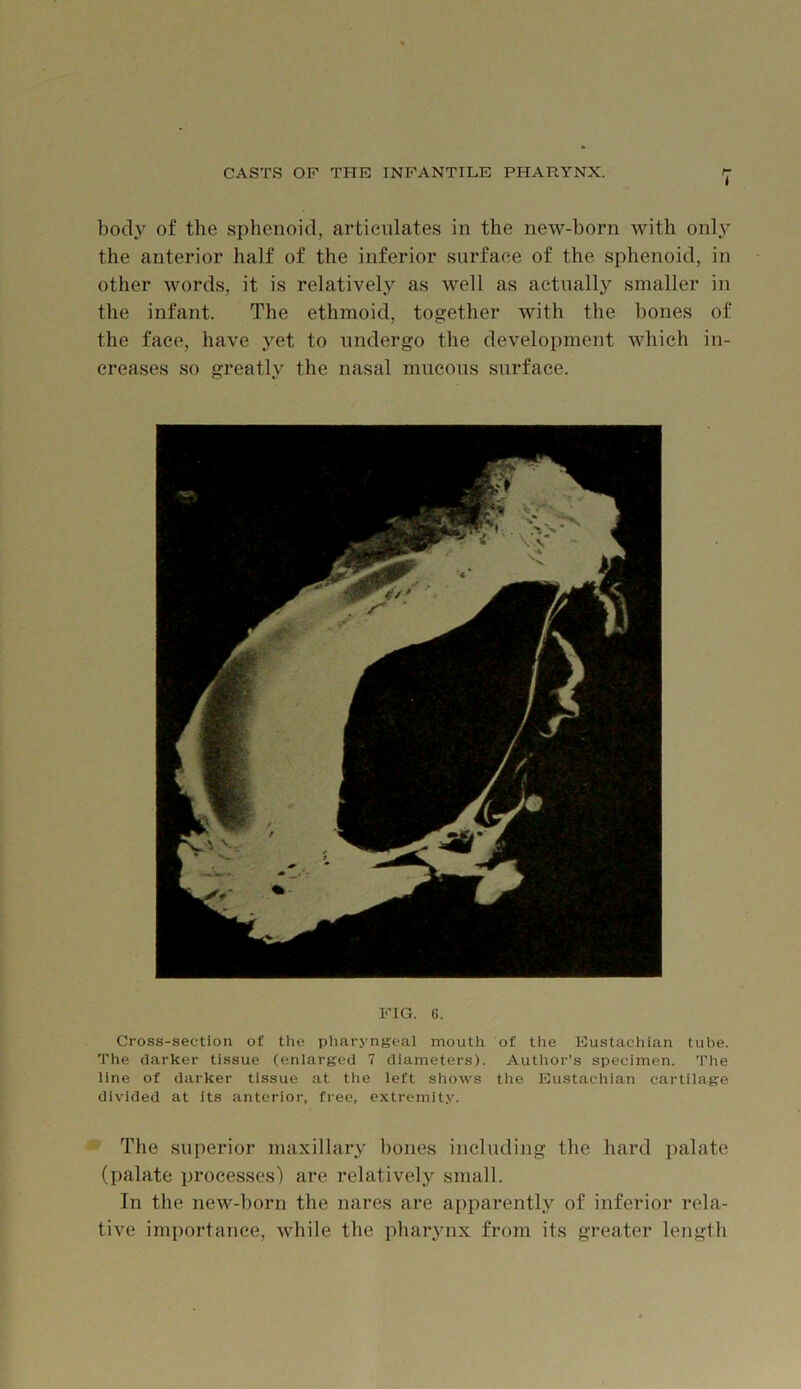 bod}' of the sphenoid, articulates in the new-born with onl}' the anterior half of the inferior surface of the sphenoid, in other words, it is relatively as well as actually smaller in the infant. The ethmoid, together with the bones of the face, have yet to undergo the development which in- creases so greatly the nasal mucous surface. FIG. 6. Cross-section of the pharyngeal mouth of the Eustachian tube. The darker tissue (enlarged 7 diameters). Author’s specimen. The line of darker tissue at tlie left shows tlie Eustachian cartilage divided at its anterior, free, extremity. The superior maxillary bones including the hard palate (palate processes') are relatively small. In the new-born the nares are apparently of inferior rela- tive importance, while the pharynx from its greater length
