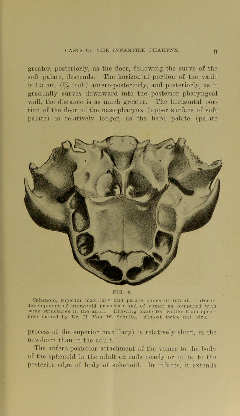 greater, posteriorly, as the floor, following the curve of the soft palate, descends. The horizontal portion of the vault is 1.5 cm. (% inch) antero-posteriorly, and posteriorly, as it gradually curves downward into the posterior pharyngeal wall, the distance is as much greater. The horizontal por- tion of the floor of the naso-phaiynx (upper surface of soft palate) is relatively longer, as the hard palate (palate FIG. 8. Sphenoid, superior maxillary and palate bones of infant. Inferior development of pterygoid processes and of vomer as compared with same structures in the adult. Drawing made for writer from speci- men loaned by Dr. H. Von W. Schulte. Almost twice nat. size. process of the superior maxillary) is relatively short, in the new-born than in the adult. The antero-posterior attachment of the vomer to the body of the sphenoid in the adult extends nearly or quite, to tlie posterior edge of bod} of sphenoid. In infants, it extends