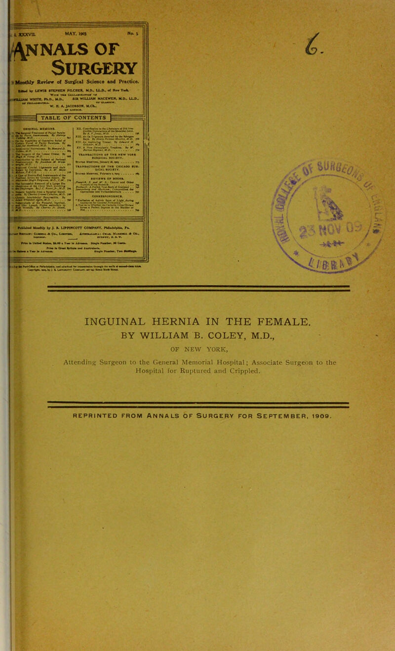 i xxxvu. MAY. 19«J3 (\NNALS OF Surgery ’ Monthly Review of Surreal Science end Practice. zmu tr lewis sttrhlw stLcnra. m-d.. lux. •< Tort. Wn» iu C»Ui»oi«»o» nf . rilXlAM WHITT. rs.D.. M.O. Sia WILUA* MACEWtH. H-tX. U-D.. M *   w. H. A. JACOESO*. M.CX.. OHOINAL UIKO.TI. TV* t-c™11>»!—* *4 r»rf»l r*r»v , at h I*** ‘ * f)«wi* I| C—imfMP *■ Ob tto NBMki t* Oranllar ».'«< <4 S*»yisi“r-. •ssr=v—3. Tto Wt^t *4 **•»•*» Vnta »j *** * r—v. Are * . CMOBM to «to VMM 4 fVr-~Bl ■ f»B«».«>*-1 »r >mO.. ti * *— Sr/;? JOra-wua. *».*.**• Mtym jtej. r ■ »* - Av* . mTd, cm, . r Tto VnW.I » — •' rf • Ut e» ■a A-In. I 4 to* Cto w.a * to.ttov-.-r* »r/c t : “rVSS.'^WSL.-^: r ■ CWtolr Uto<totoK# rBsotoitl*. I| turn* **v.*-‘~ ■*— “ »r a; m, O i/trt. M D r. A *r- Ottaatorlr T-rrAtot f.-lr-H./tmlVD TRANSACTION* or THE MEW YOU* •UMICAL SOCIETY. n*r»» M»^n»a. ;»wt to >*•) m him Himn. frW»r> 1.toi REVIEW* or EOOE*. Wll A r I CBB.tr an* Oto 4m*b.* A htto T t ti i—* a* Ata.fy . COBRBBrONOBNCS. * Eartoaloa W Act!.* Ban * U»to 4i 1M Itoaw lot Own! !>■«««', '• . 71* A Tat. •• la Mtottot tat < , h. -• L'rtoa ra.tot br j. s. ufpthcott cowaky. iuaI*1*14*. r«. R Co^ T imitoi inaiunn Ciu. Miunu A frto. to UbNbE Stotoa. U.N a Tar U S Ttat |a AAtaaaa. *4a*to tatar, M Cato. CaarAgac w-v Vr I E Utotacnrr C ijU/til INGUINAL HERNIA IN THE FEMALE. BY WILLIAM B. COLEY, M.D., OF NEW YORK, Attending Surgeon to the General Memorial Hospital; Associate Surgeon to the Hospital for Ruptured and Crippled. REPRINTED FROM ANNALS OF SURGERY FOR SEPTEMBER, 1909.