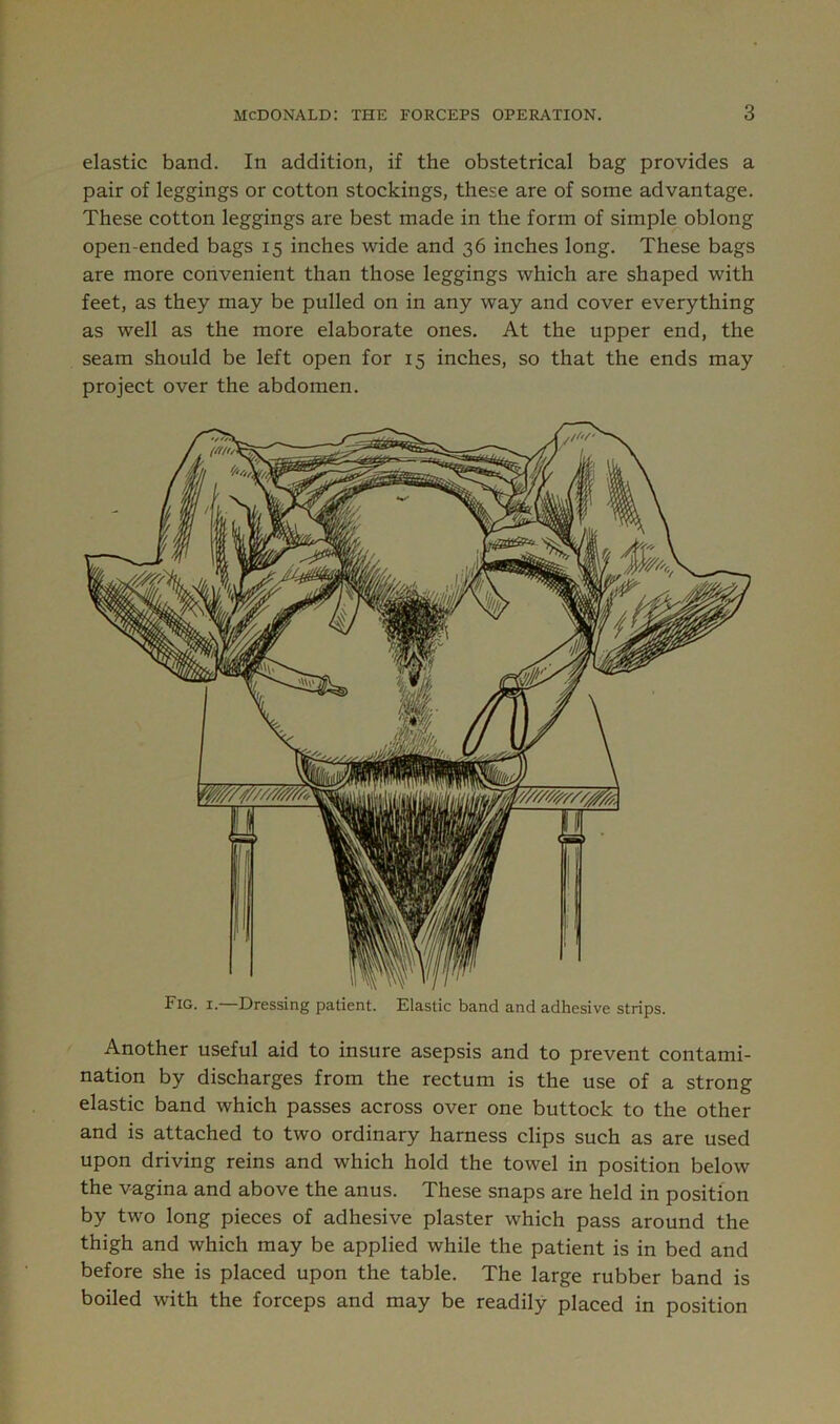 elastic band. In addition, if the obstetrical bag provides a pair of leggings or cotton stockings, these are of some advantage. These cotton leggings are best made in the form of simple oblong open-ended bags 15 inches wide and 36 inches long. These bags are more convenient than those leggings which are shaped with feet, as they may be pulled on in any way and cover everything as well as the more elaborate ones. At the upper end, the seam should be left open for 15 inches, so that the ends may project over the abdomen. Fig. I.—Dressing patient. Elastic band and adhesive strips. Another useful aid to insure asepsis and to prevent contami- nation by discharges from the rectum is the use of a strong elastic band which passes across over one buttock to the other and is attached to two ordinary harness clips such as are used upon driving reins and which hold the towel in position below the vagina and above the anus. These snaps are held in position by two long pieces of adhesive plaster which pass around the thigh and which may be applied while the patient is in bed and before she is placed upon the table. The large rubber band is boiled with the forceps and may be readily placed in position