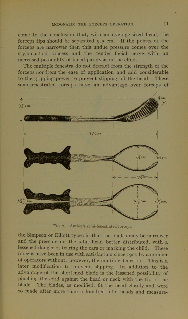 come to the conclusion that, with an average-sized head, the forceps tips should be separated 5.5 cm. If the points of the forceps are narrower then this undue pressure comes over the stylomastoid process and the tender facial nerve with an increased possibility of facial paralysis in the child. The multiple fenestra do not detract from the strength of the forceps nor from the ease of application and add considerable to the gripping power to prevent slipping off the head. These semi-fenestrated forceps have an advantage over forceps of Fig. 7.—Author’s semi-fenestrated forceps. the Simpson or Elliott types in that the blades may be narrower and the pressure on the fetal head better distributed, with a lessened danger of tearing the ears or marking the child. These forceps have been in use with satisfaction since 1904 by a number of operators without, however, the multiple fenestra. This is a later modification to prevent slipping. In addition to the advantage of the shortened blade is the lessened possibility of pinching the cord against the head or neck with the tip of the blade. The blades, as modified, fit the head closely and were so made after more than a hundred fetal heads and measure-