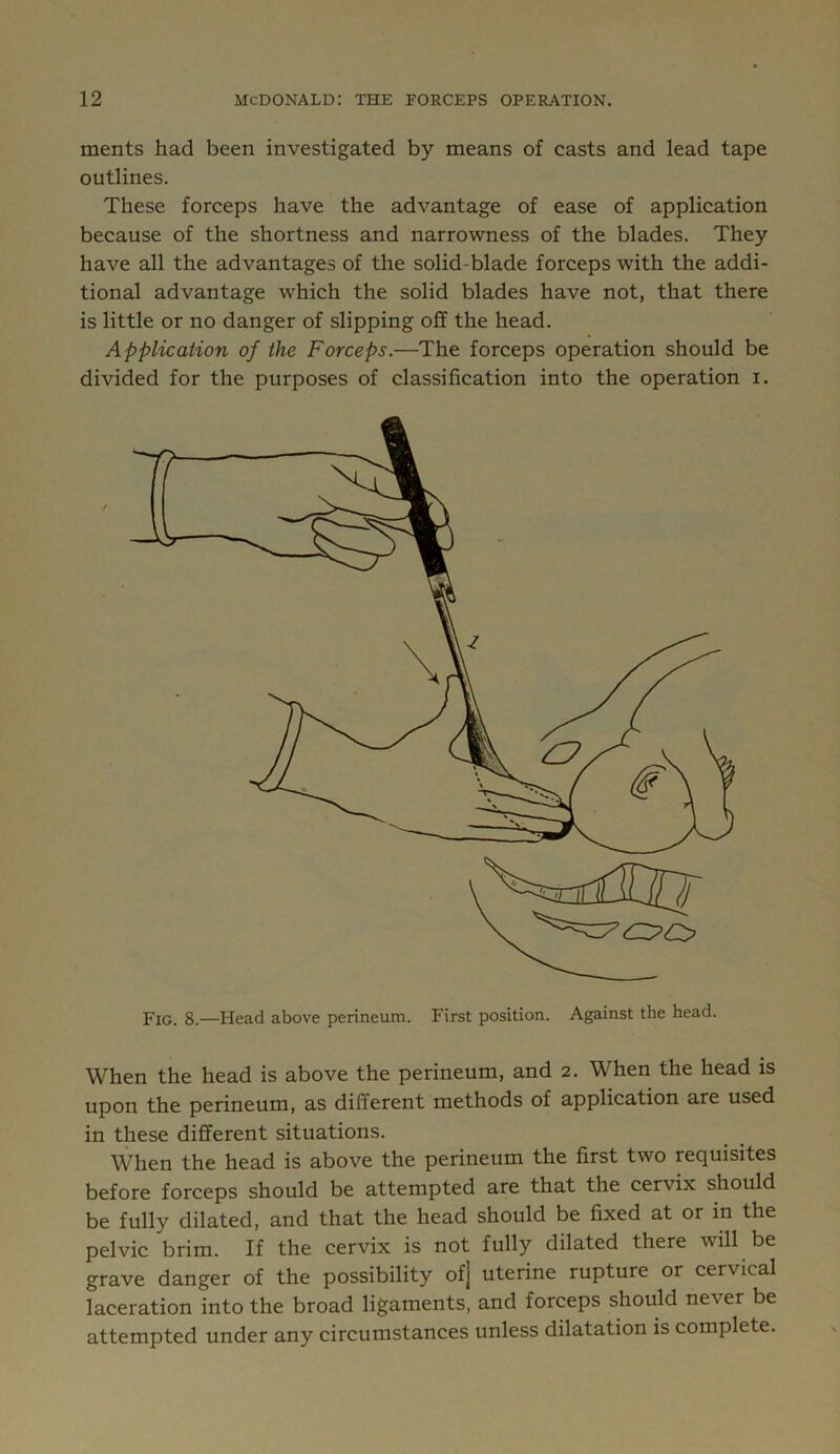 ments had been investigated by means of casts and lead tape outlines. These forceps have the advantage of ease of application because of the shortness and narrowness of the blades. They have all the advantages of the solid-blade forceps with the addi- tional advantage which the solid blades have not, that there is little or no danger of slipping off the head. Application of the Forceps.—The forceps operation should be divided for the purposes of classification into the operation i. f Fig. 8.—Head above perineum. First position. Against the head. When the head is above the perineum, and 2. When the head is upon the perineum, as different methods of application are used in these different situations. When the head is above the perineum the first two requisites before forceps should be attempted are that the cervix should be fully dilated, and that the head should be fixed at or in the pelvic brim. If the cervix is not fully dilated there will be grave danger of the possibility of] uterine rupture or cervical laceration into the broad ligaments, and forceps should never be attempted under any circumstances unless dilatation is complete.