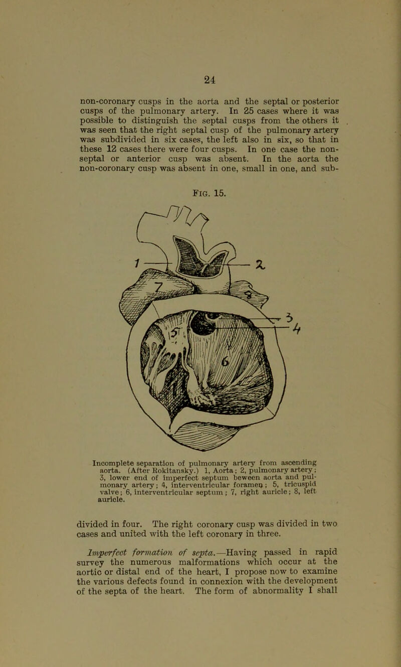 non-coronary cusps in the aorta and the septal or posterior cusps of the pulmonary artery. In 25 cases where it was possible to distinguish the septal cusps from the others it was seen that the right septal cusp of the pulmonary artery was subdivided in six cases, the left also in six, so that in these 12 cases there were four cusps. In one esse the non- septal or anterior cusp was absent. In the aorta the non-coronary cusp was absent in one, small in one, and sub- Fig. 15. Incomplete separation of pulmonary artery from ascending aorta. (After Kokitansky.) 1, Aorta; 2, pulmonary artery; 3, lower end of Imperfect septum beween aorta and pul- monary artery; 4, interventricular forameo; 5, tricuspid valve; 6, interventricular septum ; 7, right auricle; 8, left auricle. divided in four. The right coronary cusp was divided in two cases and united with the left coronary in three. Im,perfect formation of septa.—Having passed in rapid survey the numerous malformations which occur at the aortic or distal end of the heart, I propose now to examine the various defects found in connexion with the development of the septa of the heart. The form of abnormality I shall