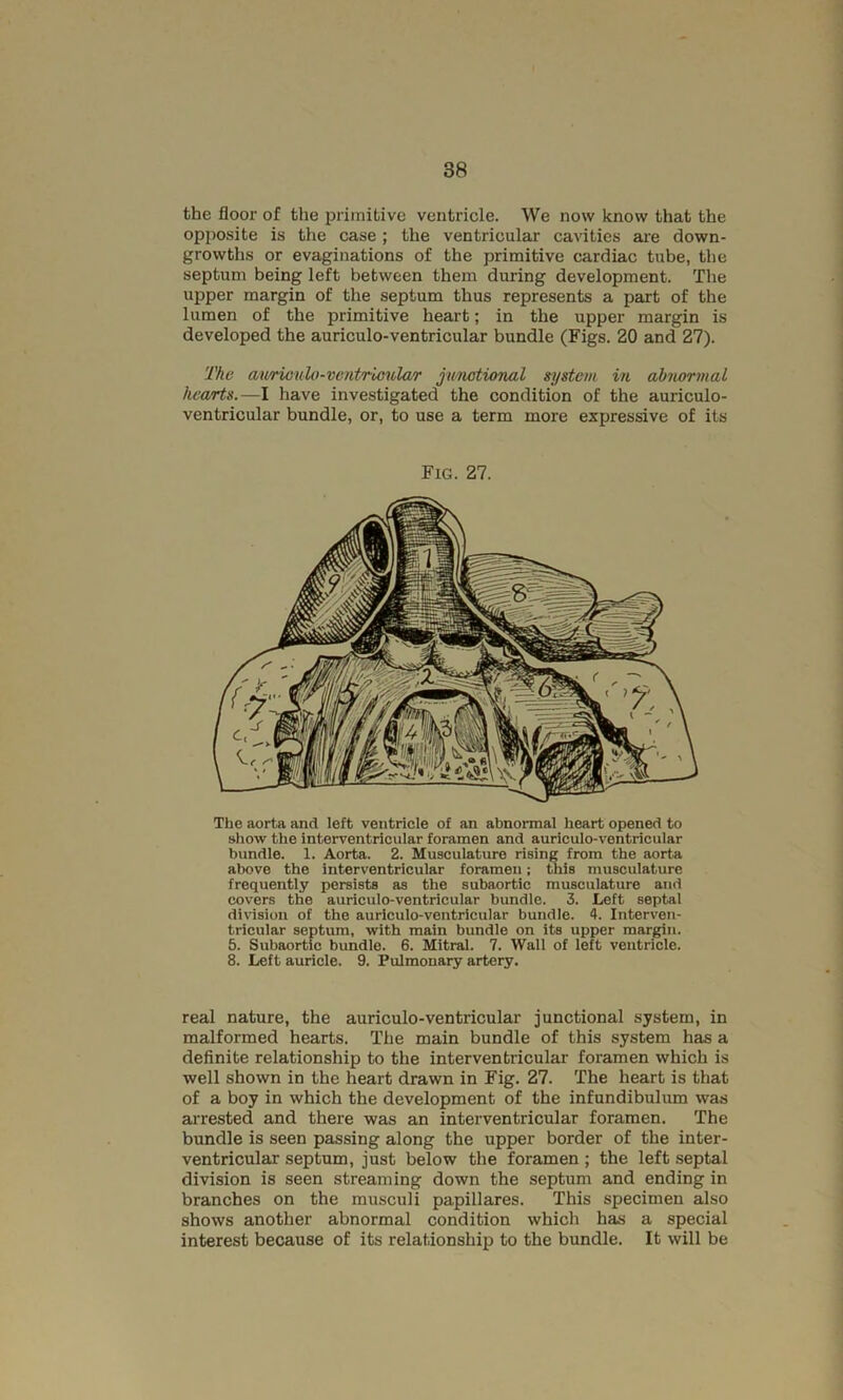 the floor of the iiriinitive ventricle. We now know that the opposite is the case ; the ventricular cavities are down- growths or evaginations of the primitive cardiac tube, the septum being left between them during development. The upper margin of the septum thus represents a part of the lumen of the primitive heart; in the upper margin is developed the auriculo-ventricular bundle (Figs. 20 and 27). The aii/riouli)-ventrloular jwmtional system in abnormal hea/rts.—I have investigated the condition of the auriculo- ventricular bundle, or, to use a term more expressive of its Fig. 27. The aorta and left ventricle of an abnormal heart opened to show the interventricular foramen and auriculo-ventricular bundle. 1. Aorta. 2. Musculature rising from the aorta above the interventricular foramen; this musculature frequently persists as the subaortic musculature and covers the auriculo-ventricular bundle. 3. Left septal division of the auriculo-ventricular bundle. 4. Interven- tricular septum, with main bundle on its upper margin. 5. Subaortic bundle. 6. Mitral. 7. Wall of left ventricle. 8. Left auricle. 9. Pulmonary artery. real nature, the auriculo-ventricular junctional system, in malformed hearts. The main bundle of this system has a definite relationship to the interventricular foramen which is well shown in the heart drawn in Fig. 27. The heart is that of a boy in which the development of the infundibulum was arrested and there was an interventricular foramen. The bundle is seen passing along the upper border of the inter- ventricular septum, just below the foramen ; the left septal division is seen streaming down the septum and ending in branches on the musculi papillares. This specimen also shows another abnormal condition which has a special interest because of its relationship to the bundle. It will be