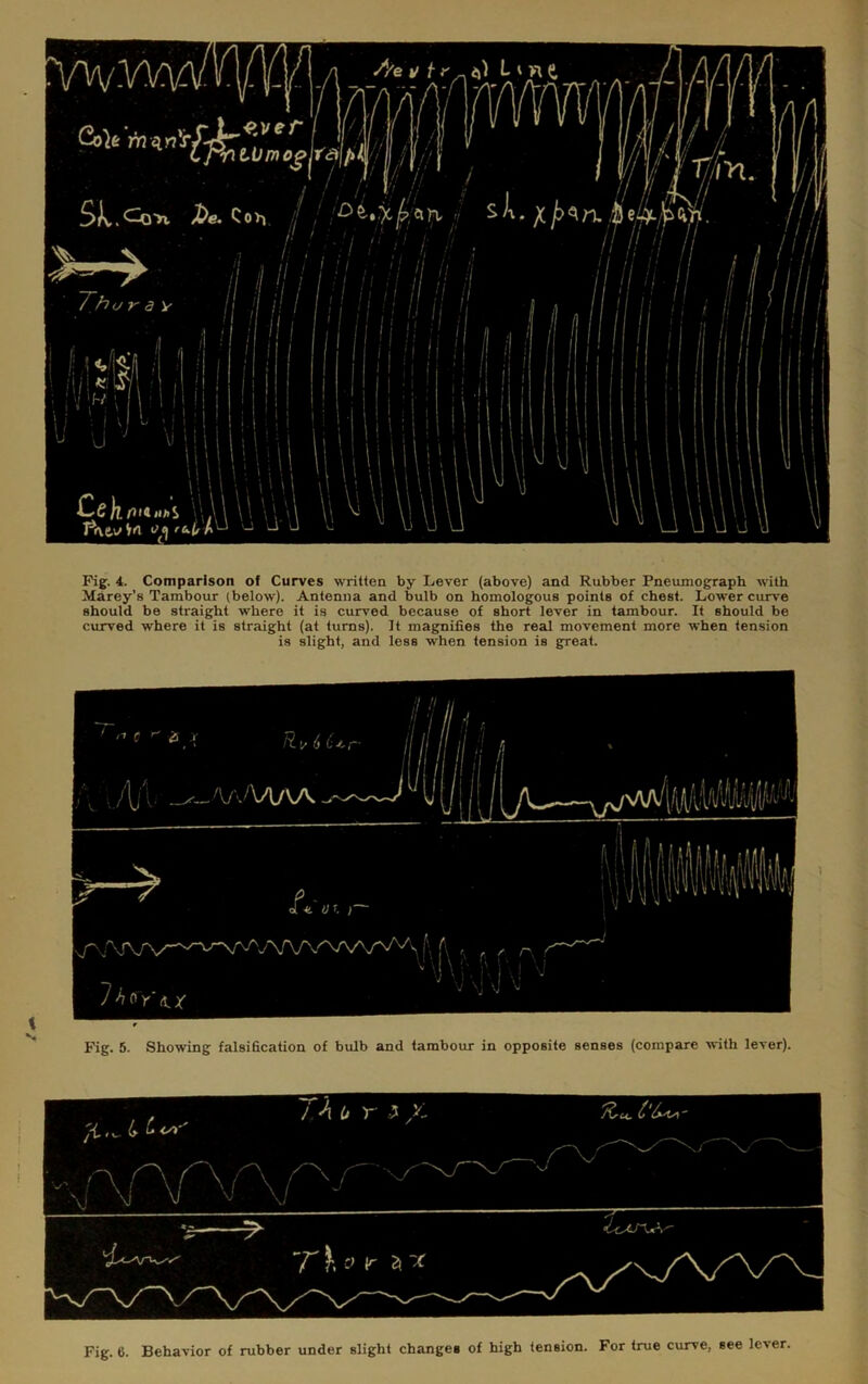 Pig. 4. Comparison of Curves written by Lever (above) and Rubber Pneumograph with Marey's Tambour (below). Antenna and bulb on homologous points of chest. Lower curve should be straight where it is curved because of short lever in tambour. It should be curved where it is straight (at turns). It mag^nifies the real movement more when tension is slight, and less when tension is great. Fig. 5. Showing falsification of btdb and tambour in opposite senses (compare with lever).