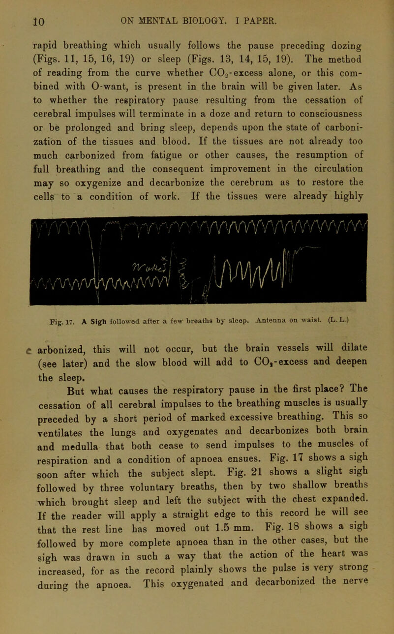 rapid breathing which usually follows the pause preceding dozing (Figs. 11, 15, 16, 19) or sleep (Figs. 13, 14, 15, 19). The method of reading from the curve whether CO.^* excess alone, or this com- bined with 0-want, is present in the brain will be given later. As to whether the respiratory pause resulting from the cessation of cerebral impulses will terminate in a doze and return to consciousness or be prolonged and bring sleep, depends upon the state of carboni- zation of the tissues and blood. If the tissues are not already too much carbonized from fatigue or other causes, the resumption of full breathing and the consequent improvement in the circulation may so oxygenize and decarbonize the cerebrum as to restore the cells to'a condition of work. If the tissues were already highly Fig. 17. A Sigh followed after a few breaths by sleep. Anteana on waist. (L. L.) C arbonized, this will not occur, but the brain vessels will dilate (see later) and the slow blood will add to CO,-excess and deepen the sleep. But what causes the respiratory pause in the first place? The cessation of all cerebral impulses to the breathing muscles is usually preceded by a short period of marked excessive breathing. This so ventilates the lungs and oxygenates and decarbonizes both brain and medulla that both cease to send impulses to the muscles of respiration and a condition of apnoea ensues. Fig. 17 shows a sigh soon after which the subject slept. Fig. 21 shows a slight sigh followed by three voluntary breaths, then by two shallow breaths which brought sleep and left the subject with the chest expanded. If the reader will apply a straight edge to this record he will see that the rest line has moved out 1.5 mm. Fig. 18 shows a sigh followed by more complete apnoea than in the other cases, but the sigh was drawn in such a way that the action of the heart was increased, for as the record plainly shows the pulse is very strong - during the apnoea. This oxygenated and decarbonized the nerve
