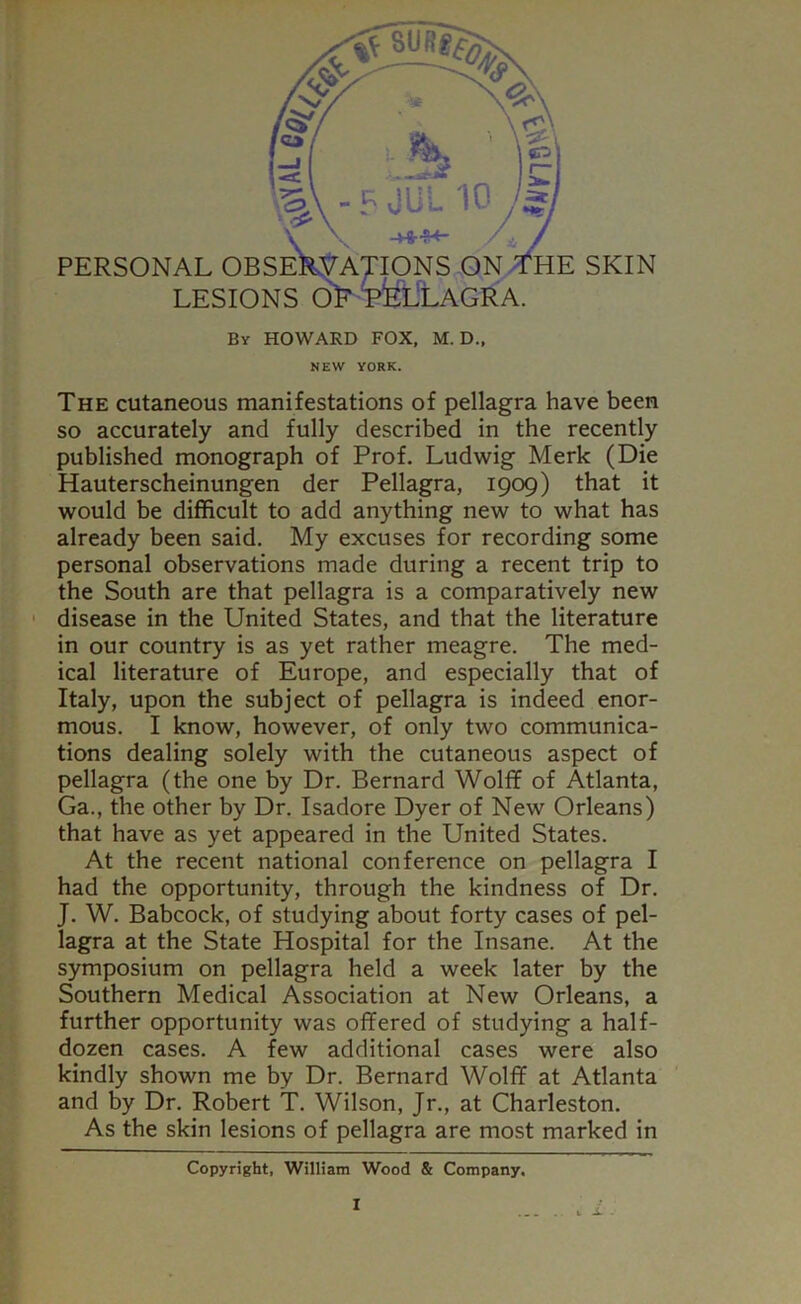 PERSONAL obseXvajions on;^he skin LESIONS 0> pfeiiLAGRA. By HOWARD FOX, M. D., NEW YORK. The cutaneous manifestations of pellagra have been so accurately and fully described in the recently published monograph of Prof, Ludwig Merle (Die Hauterscheinungen der Pellagra, 1909) that it would be difficult to add anything new to what has already been said. My excuses for recording some personal observations made during a recent trip to the South are that pellagra is a comparatively new ' disease in the United States, and that the literature in our country is as yet rather meagre. The med- ical literature of Europe, and especially that of Italy, upon the subject of pellagra is indeed enor- mous. I know, however, of only two communica- tions dealing solely with the cutaneous aspect of pellagra (the one by Dr. Bernard Wolff of Atlanta, Ga., the other by Dr. Isadore Dyer of New Orleans) that have as yet appeared in the United States. At the recent national conference on pellagra I had the opportunity, through the kindness of Dr, J. W. Babcock, of studying about forty cases of pel- lagra at the State Hospital for the Insane. At the symposium on pellagra held a week later by the Southern Medical Association at New Orleans, a further opportunity was offered of studying a half- dozen cases. A few additional cases were also kindly shown me by Dr. Bernard Wolff at Atlanta and by Dr. Robert T. Wilson, Jr., at Charleston. As the skin lesions of pellagra are most marked in Copyright, William Wood & Company.