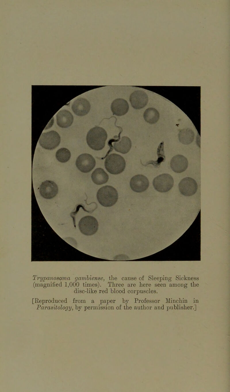 Trypanosoma gambiense, the cause of Sleeping Sickness (magnified 1,000 times). Three are here seen among the disc-like red blood corpuscles. [Reproduced from a paper by Professor Mincliin in Parasitology, by permission of the author and publisher.]