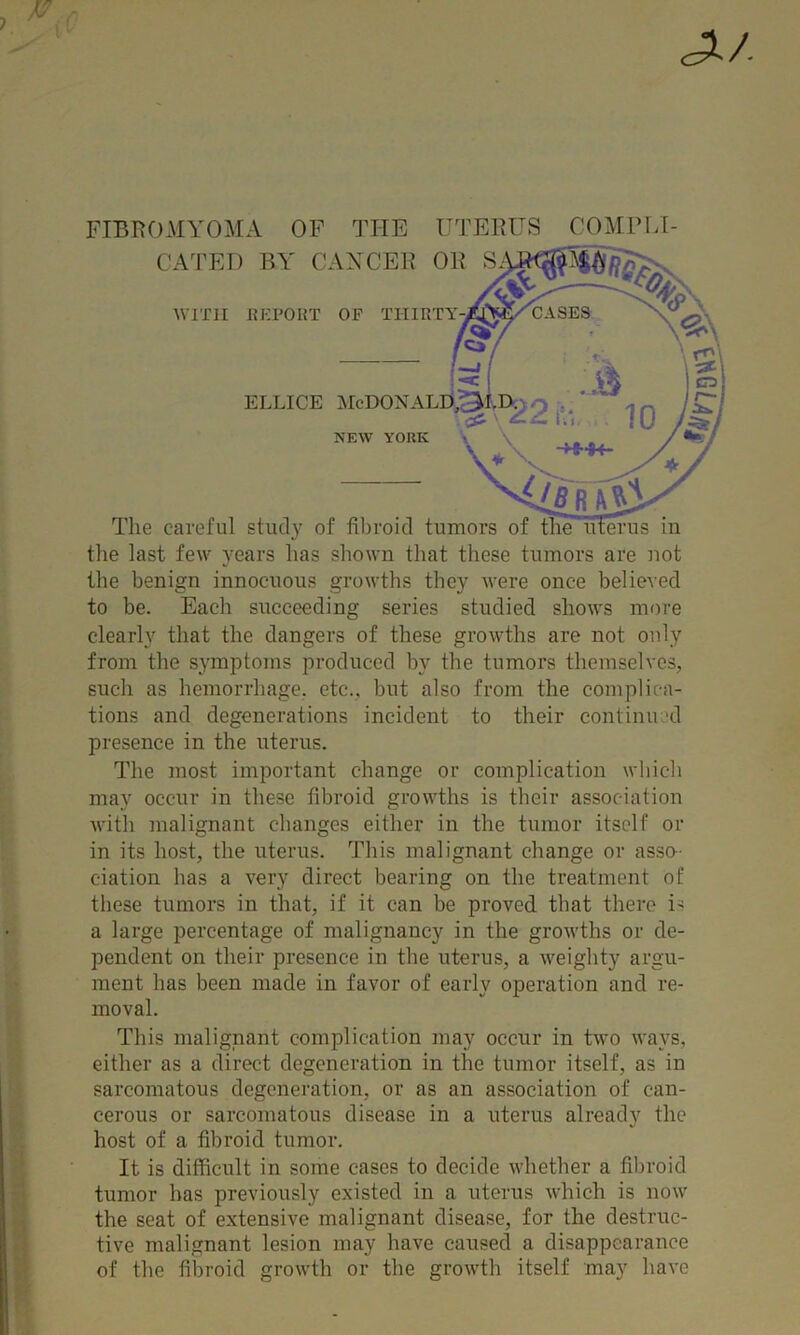FIBROMYOMA OF THE UTEBUS COMFLI- CATED BY CAXCEB 0 Tlie careful study of fibroid tui . tlie last few years has sliown that these tumors are not the benign innocuous growths they were once believed to be. Each succeeding series studied shows more clearly that the dangers of these growths are not only from the symptoms produced by the tumors themselves, such as heinorrhage. etc., but also from the complica- tions and degenerations incident to their continu;-d presence in the uterus. The most important change or complication which may occur in these fibroid growths is their association with malignant changes either in the tumor itself or in its host, the uterus. This malignant change or asso- ciation has a very direct bearing on the treatment of these tumors in that, if it can be proved that there is a large percentage of malignancy in the growths or de- pendent on their presence in the uterus, a weighty argu- ment has been made in favor of early operation and re- moval. This malignant complication may occur in two ways, either as a direct degeneration in the tumor itself, as in sarcomatous degeneration, or as an association of can- cerous or sarcomatous disease in a uterus already the host of a fibroid tumor. It is difficult in some cases to decide whether a fil)roid tumor has previously e.xisted in a uterus which is now the seat of extensive malignant disease, for the destruc- tive malignant lesion may have caused a disappearance of the fibroid growth or the growth itself may have WITH KMPORT OF THIRT'! ELLICE IMcDONALE NEW YORK