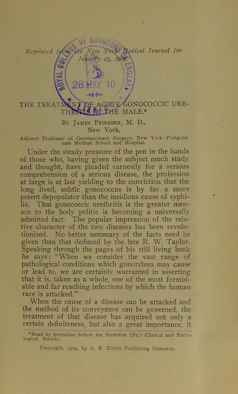 By James Pedersen, M. D., New York, Adjunct Professor of Genitourinary Surgery, New York Postgrad- uate Medical School and Hospital. Under the steady pressure of the pen in the hands of those who, having given the subject much study and thought, have pleaded earnestly for a serious comprehension of a serious disease, the profession at large is at last yielding to the conviction that the long lived, subtle gonococcus is by far a more potent depopulator than the insidious cause of syphi- lis. That gonococcic urethritis is the greater men- ace to the body politic is becoming a universally admitted fact. The popular impression of the rela- tive character of the two diseases has been revolu- tionized. No better summary of the facts need be given than that deduced by the late R. W. Taylor. Speaking through the pages of his still living book he says: “When we consider the vast range of pathological conditions which gonorrhoea may cause or lead to, we are certainlv warranted in asserting that it is, taken as a w'hole, one of the most formid- able and far reaching infections by which the human race is attacked.” When the cause of a disease can be attacked and the method of its conveyance can be governed, the treatment of that disease has acquired not only a certain definiteness, but also a great importance, it •Read by invitation before the Scranton (Pa.) Clinical and Patho- logical Society. Copyright, J909, by A. R. Elliott Publishing Company.