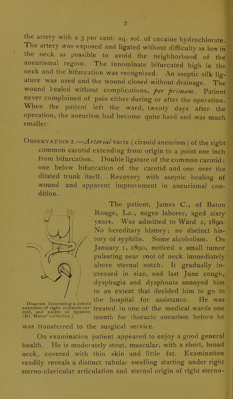 the artery with a 3 per cent. aq. sol. of cocaine hydrochlorate. The artery was exposed and ligated without difficulty as low in the neck as possible to avoid the neighborhood of the aneurismal region. The innominate bifurcated high in the neck and the bifurcation was recognized. An aseptic silk lig- ature was used and the wound closed without drainage. The wound healed without complications, -per primam. Patient never complained of pain either during or after the operation. When the patient left the ward, twenU'^ days after the operation, the aneurism had become quite hard and was much smaller. Observation 2.—Arterial varix (cirsoid aneurism) of the right common carotid extending from origin to a point one inch from bifurcation. Double ligature of the common carotid; one below bifurcation of the carotid and one over the dilated trunk itself. Recover}^ with aseptic healing of wound and apparent improvement in aneurismal con- dition. The patient, James C., of Baton Rouge, La., negro laborer, aged sixty years. Was admitted to Ward 2, 1890. No hereditary history; no distinct his- tory of syphilis. Some alcoholism. On Januaiy i, 1890, noticed a small tumor pulsating near root of neck immediately above sternal notch. It gradually in- creased in size, and last June cough, d}^sphagia and dysphonia annoyed him to an extent that decided him to go to .the hospital for assistance. He was Diagram illustrating a cirsoid '■ aneurism of right common car- treated in One of the medical wards one otid, and points of lig'ation. (Dr. Matas’collection.) month foi‘ ihoi'acic aneurism before he was transferred to the surgical service. On examination patient appeared to enjoy a good general health. He is moderatel}^ stout, muscular, with a short, broad neck, covered with thin skin and little fat. Examination readily reveals a distinct tubular swelling starting under right sterno-clavicular articulation and sternal origin of right sterno-