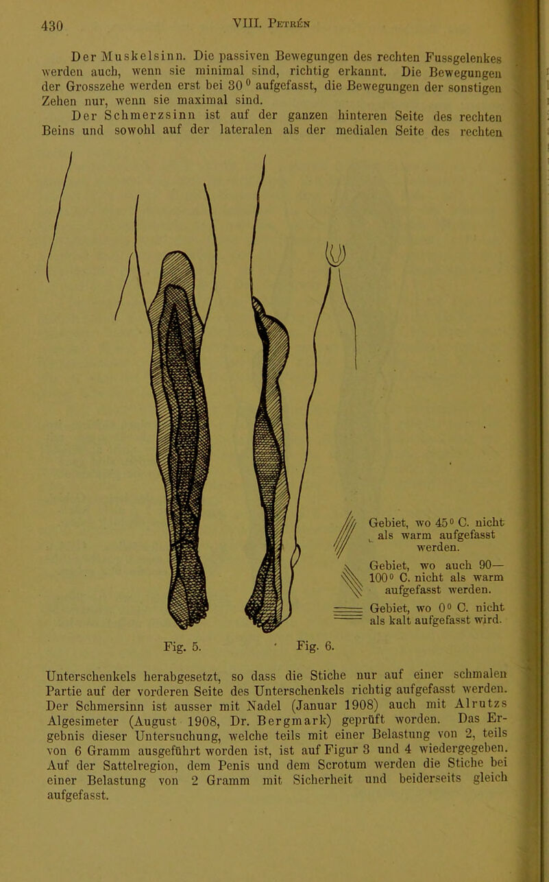 Der Muskelsinn. Die passiven Bewegungen des rechten Fussgelenkes werden auch, wenn sie minimal sind, richtig erkannt. Die Bewegungen der Grosszehe werden erst bei 30 ® aufgefasst, die Bewegungen der sonstigen Zehen nur, wenn sie maximal sind. Der Schmerzsinn ist auf der ganzen hinteren Seite des rechten Beins und sowohl auf der lateralen als der medialen Seite des rechten Gebiet, wo 45® C. nicht als warm aufgefasst werden. Gebiet, wo auch 90— 100® C. nicht als warm aufgefasst werden. Gebiet, wo 0® 0. nicht als kalt aufgefasst wird. Fig. 5. Fig. 6. Unterschenkels herabgesetzt, so dass die Stiche nur auf einer schmalen Partie auf der vox’deren Seite des Unterschenkels richtig aufgefasst werden. Der Schmersinn ist ausser mit Nadel (Januar 1908) auch mit Alrutzs Algesimeter (August 1908, Dr. Bergmark) geprüft worden. Das Er- gebnis dieser Untersuchung, welche teils mit einer Belastung von 2, teils von 6 Gramm ausgeführt worden ist, ist auf Figur 8 und 4 wiedergegeben. Auf der Sattelregion, dem Penis und dem Scrotum werden die Stiche bei einer Belastung von 2 Gramm mit Sicherheit und beiderseits gleich aufgefasst.
