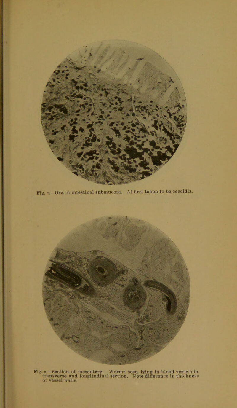 » t ■ Fig. 2.—Section of mesentery. Worms seen lying in blood vessels in transverse and longitudinal section. Note difi'erence in thickness of vessel walls.