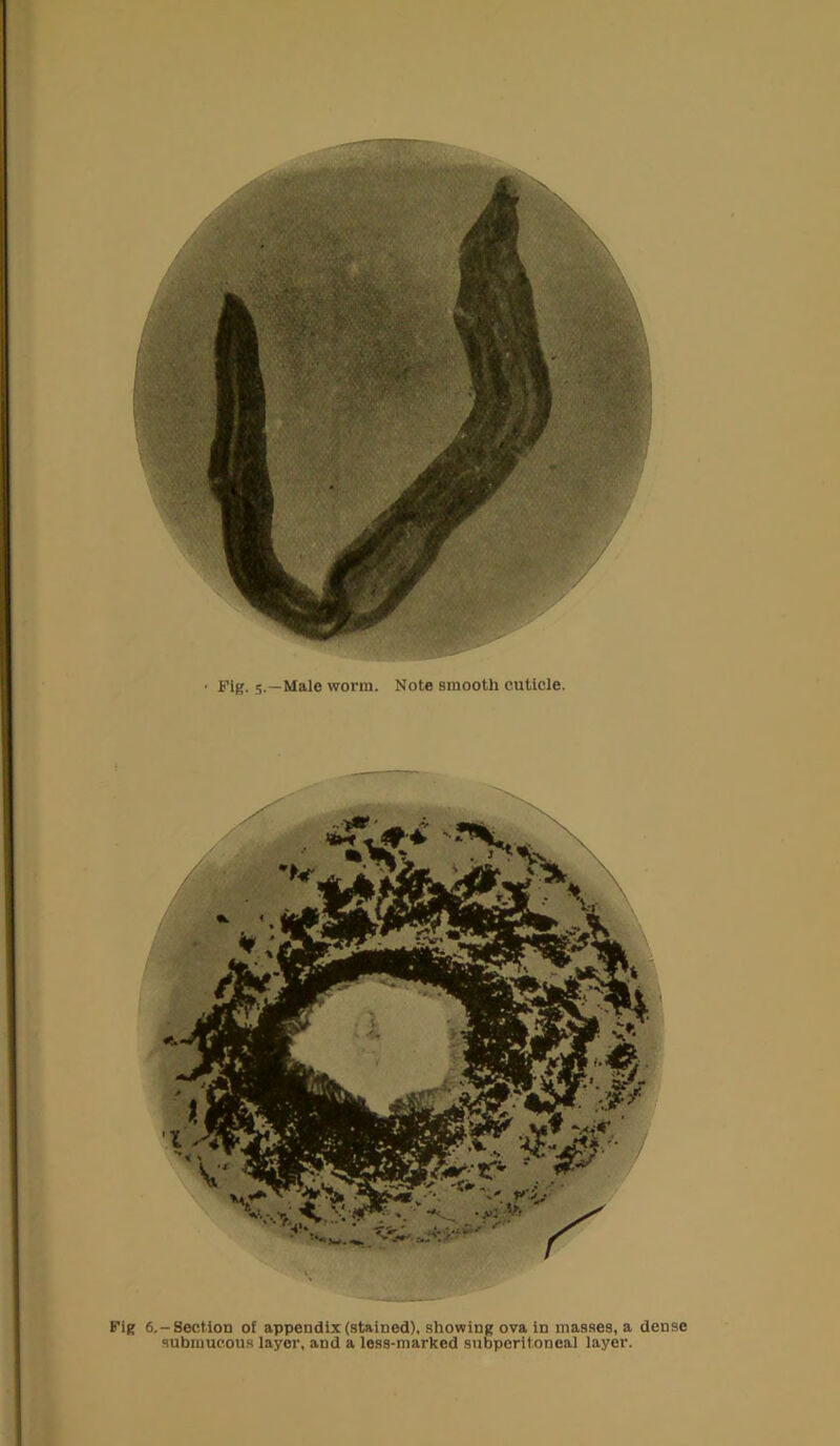 submucous layer, and a less-marked subperitoneal layer.