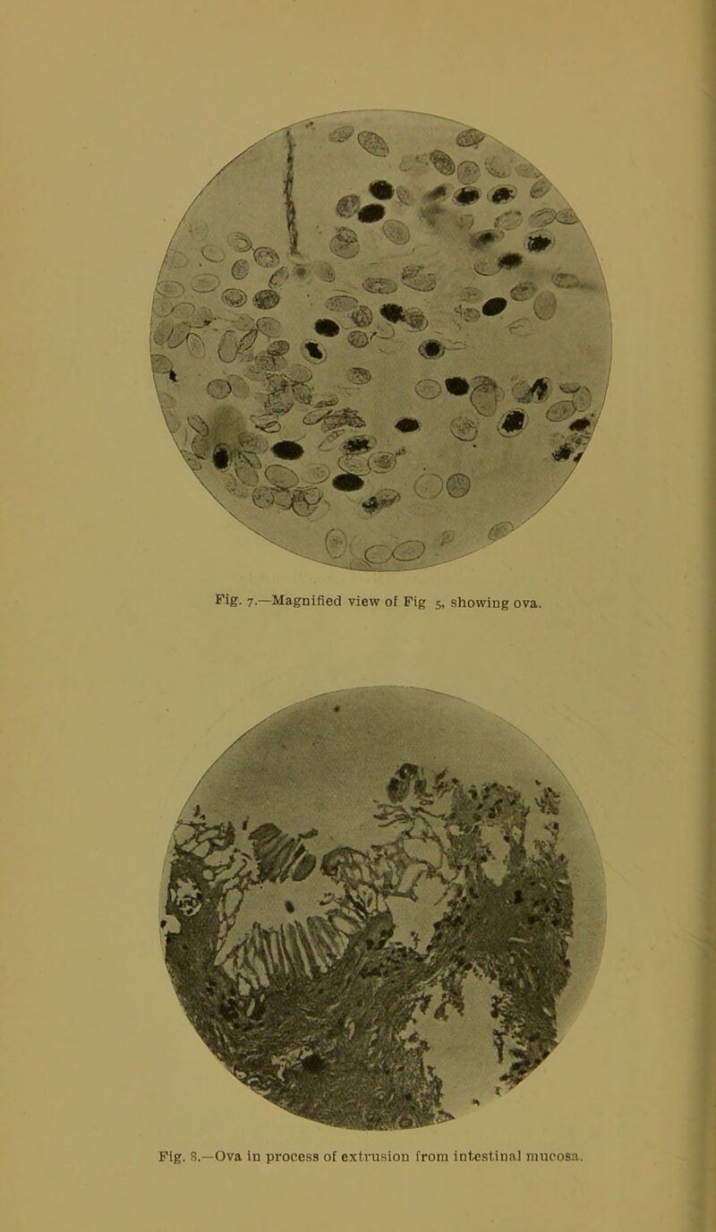 m- Fig. 7.—Magnified view of Fig 5, showing ova. Fig. 8.—Ova in process of extrusion from intestinal mucosa.