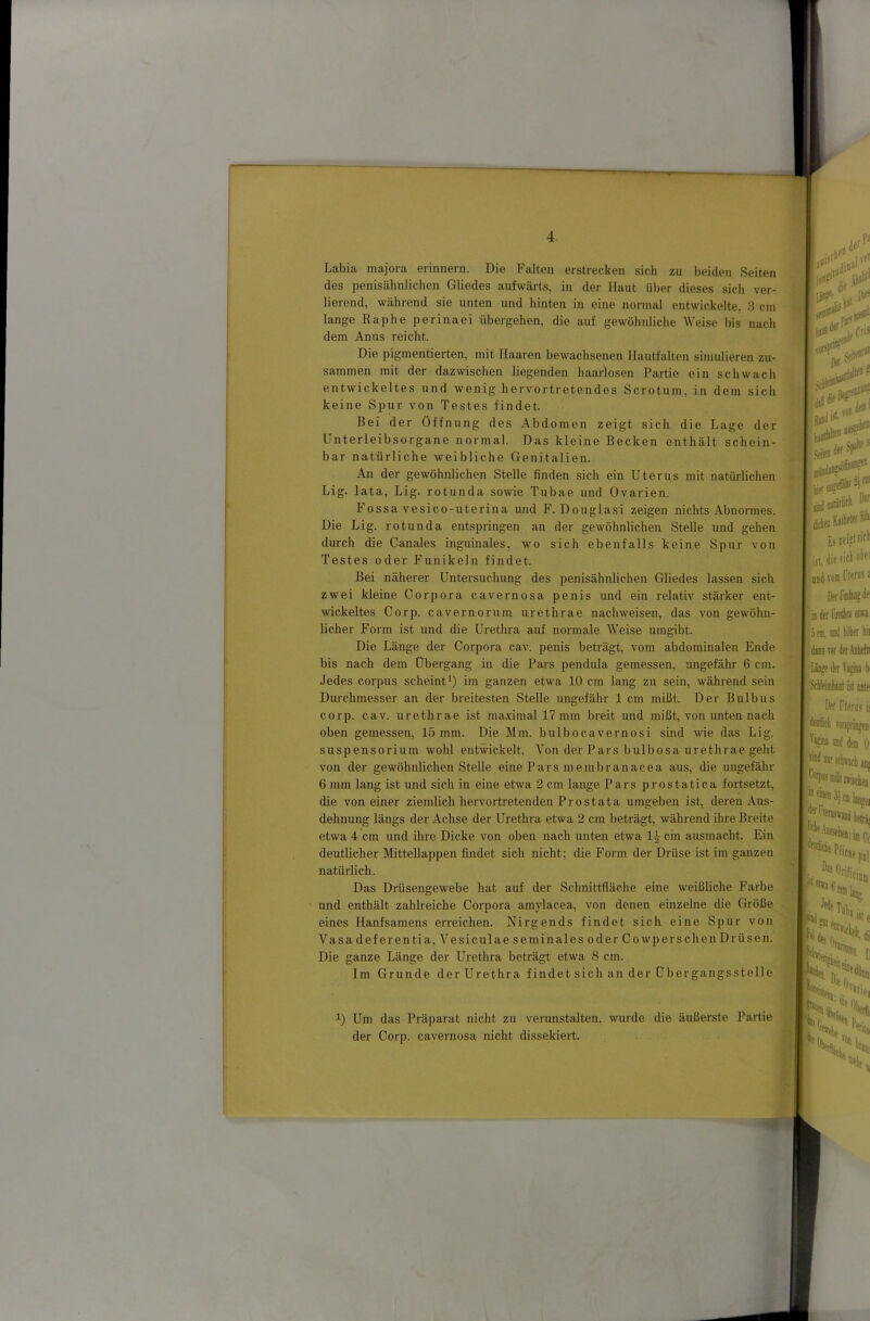 I Labia majora erinnern. Die Falten erstrecken sich zu beiden Seiten des penisähnlicben Gliedes aufwärts, in der Haut über dieses sich ver lierend, während sie unten und hinten in eine normal entwickelte, 3 cm lange Raphe perinaei übergehen, die auf gewöhnliche Weise bis nach dem Anus reicht. Die pigmentierten, mit Haaren bewachsenen Hautfalten simulieren zu- sammen mit der dazwischen liegenden haarlosen Partie ein schwach entwickeltes und wenig hervortretendes Scrotum, in dem sich keine Spur von Testes findet. Bei der Öffnung des Abdomen zeigt sich die Lage der Unterleibsorgane normal. Das kleine Becken enthält schein- bar natürliche weibliche Genitalien. An der gewöhnlichen Stelle finden sich ein Uterus mit natürlichen Lig. lata, Lig. rotunda sowie Tubae und Ovarien. Fossa vesico-uterina und F. Douglasi zeigen nichts Abnormes. Die Lig. rotunda entspringen an der gewöhnlichen Stelle und gehen durch die Canales inguinales, wo sich ebenfalls keine Spur von Testes oder Funikeln findet. Bei näherer Untersuchung des penisähnlichen Gliedes lassen sich zwei kleine Corpora cavernosa penis und ein relativ stärker ent- wickeltes Corp. cavernorum urethrae nach weisen, das von gewöhn- licher Form ist und die Urethra auf normale Weise umgibt. Die Länge der Corpora cav. penis beträgt, vom abdominalen Ende bis nach dem Übergang in die Pars pendula gemessen, ungefähr 6 cm. Jedes Corpus scheint Ö im ganzen etwa 10 cm lang zu sein, während sein Durchmesser an der breitesten Stelle ungefähr 1 cm mißt. Der Bulbus corp. cav. urethrae ist maximal 17 mm breit und mißt, von unten nach oben gemessen, 15 mm. Die Mm. bulbocavernosi sind wie das Lig. Suspensorium wohl entwckelt. Von der Pars bulbosa urethrae geht von der gewöhnlichen Stelle eine Pars membranacea aus, die ungefähr 6 mm lang ist und sich in eine etwa 2 cm lange Pars prostatica fortsetzt, die von einer ziemlich hervortretenden Prostata umgeben ist, deren Aus- dehnung längs der Achse der Urethra etwa 2 cm beträgt, während ihre Breite etwa 4 cm und ihre Dicke von oben nach unten etwa 14 ein ausmacht. Ein deutlicher Mttellappen findet sich nicht; die P'orm der Drüse ist im ganzen Vj natürlich. Das Drüsengewebe hat auf der Schnittfläche eine weißliche Farbe und enthält zahlreiche Corpora amylacea, von denen einzelne die Größe eines Hanfsamens erreichen. Nirgends findet sich eine Spur von Vasa deferentia,A^esiculaeseminales oder Cowpersehen Drüsen. Die ganze Länge der Urethra beträgt etwa 8 cm. Im Grunde der Urethra findet sich an der Übergangsstelle li*!- von dfUll ist, foll £s,eiftsicl die sick obei 1 vom l'ifms I ia der UmIui ön dem. imd köker kii duiovorder.yiefti Iiii»e der Vasiia b SfkleimkaDl i.i( mie Der rierns ii rorspiii®ii ^^nirsthnckjiij V'miktnuttet Um das Präparat nicht zu verunstalten, wurde die äußerste Partie der Corp. cavernosa nicht dissekiert. *«:iiiiC< “fül iste I '«st «ll,