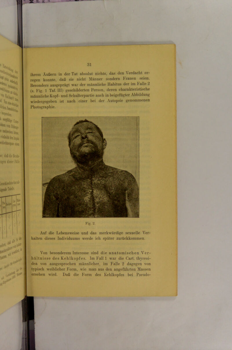 tutet. lohlechisoi irjaoe i 31 ihrem Äußern in der Tat absolut nichts, das den Verdacht er- regen konnte, daß sie nicht Männer sondern hiauen seien. Besonders ausgeprägt war der männliche Habitus der im Falle 2 (s. Fig. 1 Taf. III) geschilderten Person, deren charakteristische männliche Kopf- und Schulterpartie auch in beigefügter Abbildung wiedergegeben ist nach einer bei der Autopsie genommenen Photographie. iijen dieser Fälle schlecbtsclurai- fG: Fig. 2. Auf die Lebensweise und das merkwürdige sexuelle Ver- halten dieses Individuums werde ich später zurückkommen. ■, VeÄ Von besonderem Interesse sind die anatomischen Ver- hältnisse des Kehlkopfes. Im Fall 1 war die Gart, thyreoi- dea von ausgesprochen männlicher, im Falle 2 dagegen von typisch weiblicher Form, wie man aus den angeführten Massen ersehen wird. Daß die Form des Kehlkopfes bei Pseudo- .i