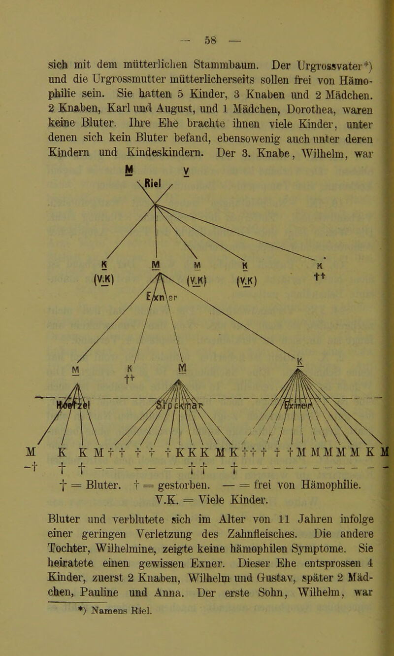 sich mit dem mütterliclien Stammbaum. Der IJrgrossvater*) und die Urgrossmutter mütterlicherseits sollen frei von Hämo- philie sein. Sie hatten 5 Kinder, 3 Knaben und 2 Mädchen. 2 Knaben, Karl und August, und 1 Mädchen, Dorothea, waren keine Bluter. Ihie Ehe brachte ihnen viele Kinder, unter denen sich kein Bluter befand, ebensowenig auch unter deren Kindern und Kindeskindern. Der 3. Knabe, Wilhelm, war M V •j* = Bluter, t = gestorben. — = frei von Hämophilie. V.K. = Viele Kinder. Bluter und verblutete sich im Alter von 11 Jahren infolge einer geringen Verletzung des Zahnfleisches. Die andere Tochter, Wilhelmine, zeigte keine hämophilen Symptome. Sie heiratete einen gewissen Exner. Dieser Ehe entsprossen 4 Kinder, zuerst 2 Knaben, Wilhelm und Gustav, später 2 Mäd- chen, Pauline und Amia. Der erste Sohn, Wilhelm, war *) Namens Riel.