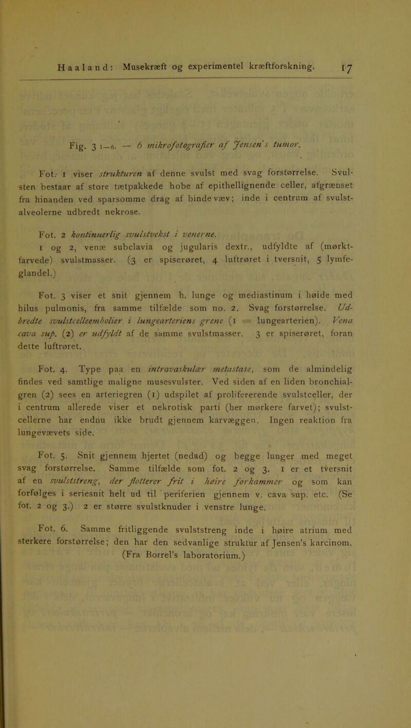 Fig. 3 1—«. — 6 mikrofotografer af Jensen s tumor. Fot. 1 viser strukturen af denne svulst med svag forstørrelse. Svul- sten bestaar af store tætpakkede hobe af epithellignende celler, afgrænset fra hinanden ved sparsomme drag af bindevæv; inde i centrum af svulst- alveolerne udbredt nekrose. Fot. 2 kontinuerlig svulstvekst i venerne. 1 og 2, venæ subclavia og jugularis dextr., udfyldte af (mørkt- farvede) svulstmasser. (3 er spiserøret, 4 luftrøret i tversnit, 5 lymfe- glandel.) Fot. 3 viser et snit gjennem h. lunge og mediastinum i høide med hilus pulmonis, fra samme tilfælde som no. 2. Svag forstørrelse. Ud- bredte svulstcelleembolier i lungearteriens grene (1 = lungearterien). Vena cava sup. (2) e-r udfyldt af de samme svulstmasser. 3 er spiserøret, foran dette luftrøret. Fot. 4. Type paa en intravaskidær metastase, som de almindelig findes ved samtlige maligne musesvulster. Ved siden af en liden bronchial- gren (2) sees en arteriegren (1) udspilet af prolifererende svulstceller, der i centrum allerede viser et nekrotisk parti (her mørkere farvet); svulst- cellerne har endnu ikke brudt gjennem karvæggen. Ingen reaktion fra lungevævets side. Fot. 5. Snit gjennem hjertet (nedad) og begge lunger med meget svag forstørrelse. Samme tilfælde som fot. 2 og 3. 1 er et tversnit af en svulststreng, der folterer frit i høire forkammer og som kan forfølges i seriesnit helt ud til periferien gjennem v. cava sup. etc. (Se fot. 2 og 3.) 2 er større svulstknuder i venstre lunge. Fot. 6. Samme fritliggende svulststreng inde i høire atrium med sterkere forstørrelse; den har den sedvanlige struktur af Jensen’s karcinom. (Fra Borrel’s laboratorium.)