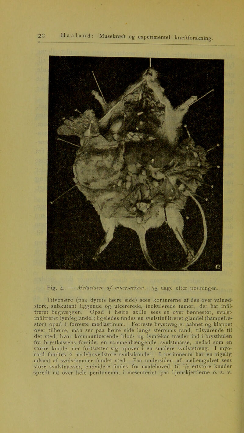 Hg. 4. — Metastaser af musesarkom. 75 dage efter podningen. Tilvenstre (paa dyrets høire side) sees konturerne af den over valnød- store, subkutant liggende og ulcererede, inokulerede tumor, der har infil- treret bugvæggen. Opad i høire axille sees en over bønnestor, svulst- infiltreret lymfeglandel; ligeledes findes en svulstinfiltreret glandel (hampefrø- stor) opad i forreste mediastinum. Forreste brystvæg er aabnet og klappet over tilhøire, man ser paa høire side langs sternums rand, tilsvarende til det sted, hvor kommunicerende blod- og lymfekar træder ind i brysthulen fra brystkassens forside, en sammenhængende svulstmasse, nedad som en større knude, der fortsætter sig opover i en smalere svulststreng. I myo- card fandtes 2 nanlehovedstore svulstknuder. I peritoneum har en rigelig udsæd af svulstknuder fundet sted. Paa undersiden af mellemgulvet sees store svulstmasser, endvidere findes fra naalehoved- til lf% ertstore knuder spredt ud over hele peritoneum, i mesenteriet paa kjønskjertlerne o. s. v.