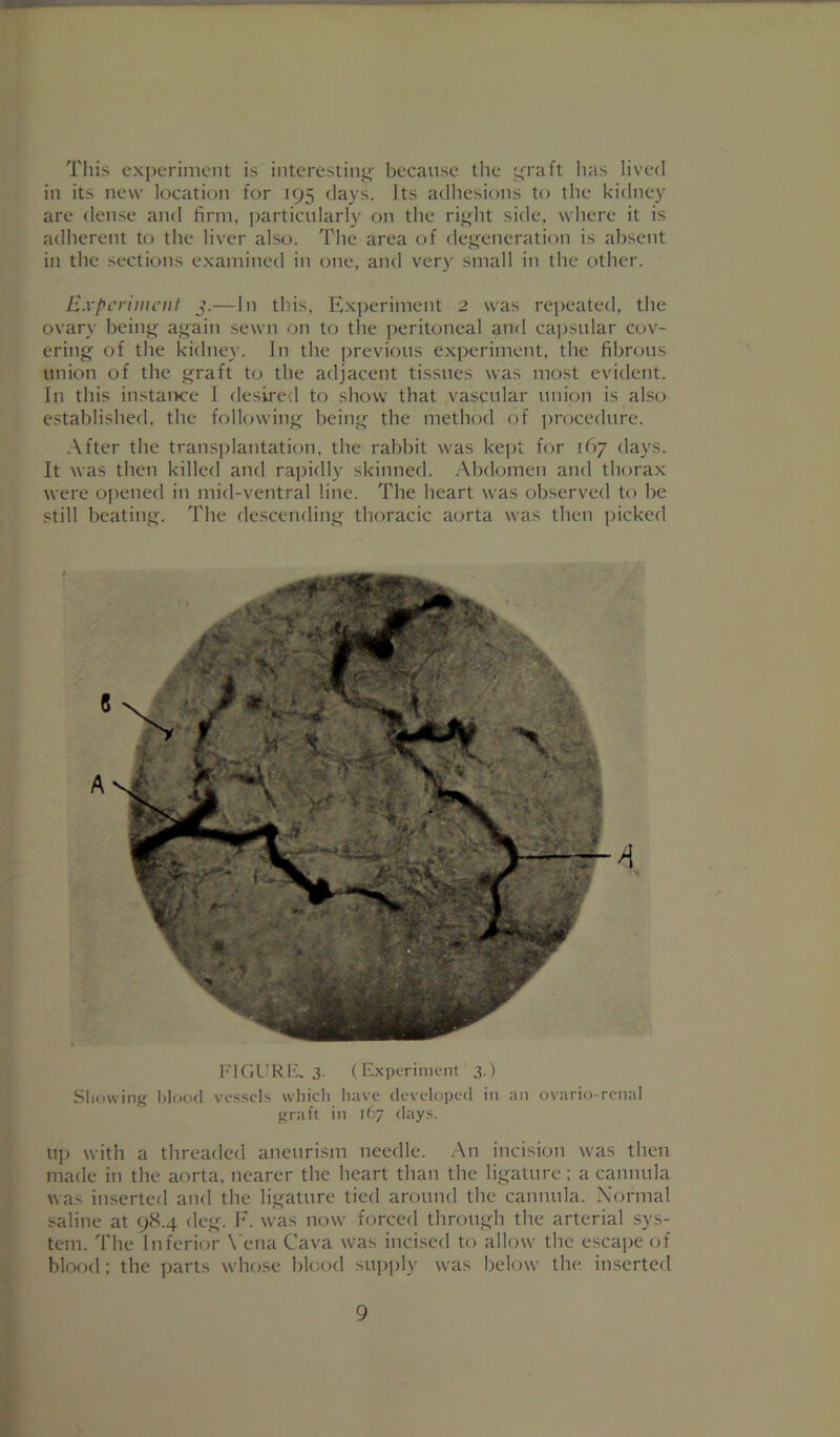 Tliis experiment is interestinj^' because the c^raft has lived in its new location for 195 days, its adhesions to the kidney are dense and rtrin, particularly on the rii^’ht side, where it is adherent to the liver also. The area of dej^eneration is absent in the .sections examined in one, and very small in the other. ISxf'criinciit j.—In this, Exjjeriment 2 was rejieated, the ovary being again sewn on to the peritoneal and capsular cov- ering of the kidney. In the previous experiment, the fibrous union of the graft to the adjacent tissues was most evident. In this instaiK'e I desire<l to show that vascular union is also established, the following being the method of pnjcedure. .\fter the transplantation, the rabbit was kejjt for 167 days. It was then killed and rajndly skinned. Abdomen and thorax were opened in mid-ventral line. The heart was observed to be still beating. The descending thoracic aorta was then ])icked I-'lCiL’KI-'. 3- f Experiment 3.) Sinewing vessels wliich liave clevelo])ed in an ovario-rcnal graft in idj days. U]j with a threaded aneurism needle. An incision was then made in the aorta, nearer the heart than the ligature: a cannula was inserted and the ligature tied around the cannula. Xormal saline at 9S.4 deg. h\ was now forced through the arterial sys- tem. The Inferior \'ena Cava was incised to allow the escape of blood; the jtarts whetse blood su])ply was below the inserterl