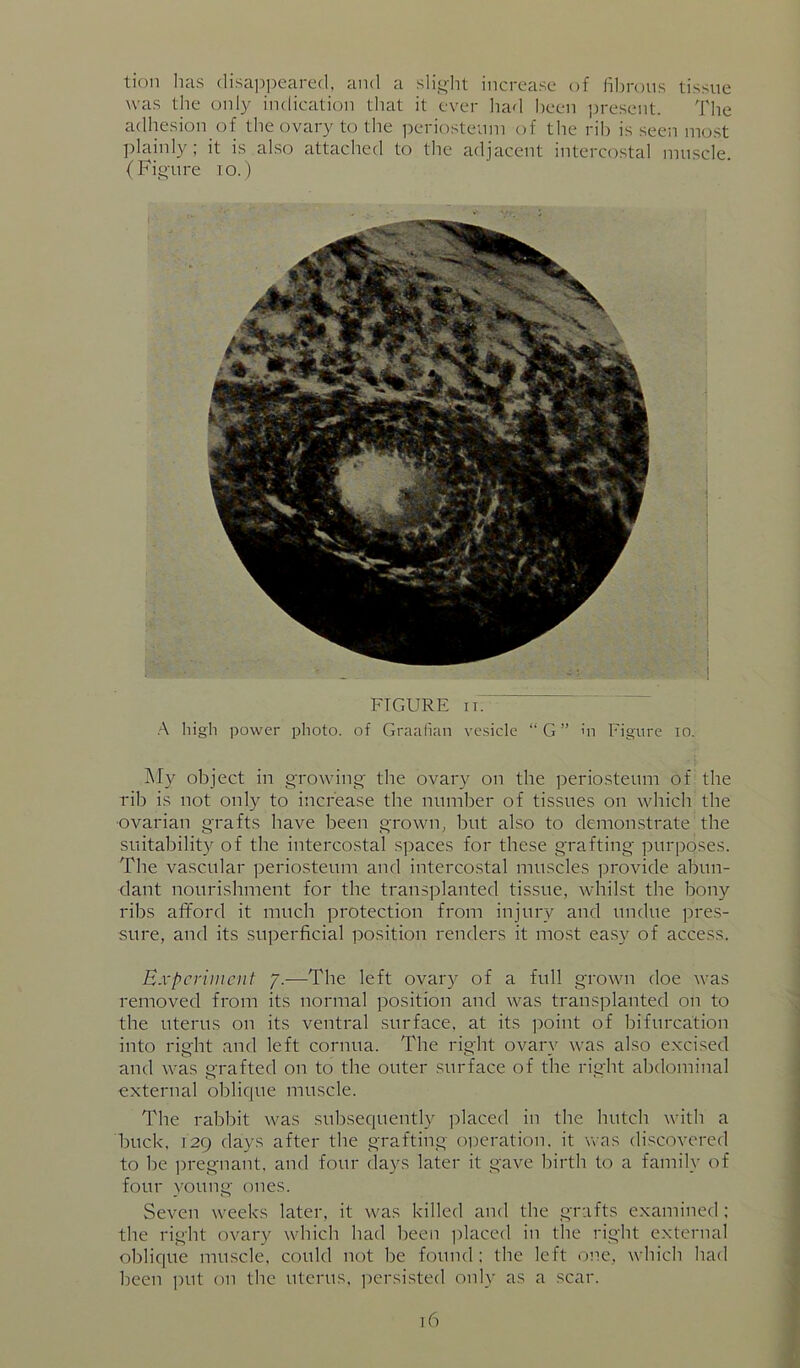 tion has (lisa])peare(l, and a slioiit increase of fibrous tissue was the only indication that it ever had l)een ])resent. Tlie adhesion of the ovary to the periosteum of the rib is seen most plainly; it is also attached to the adjacent intercostal muscle. (Fio'ure 10.) FIGURE II. •A high power photo, of Graafian ve.sicle “ G ” 'n Figure lo. My object in growing- the ovary on the periosteum of the rib is not only to increase the number of tissues on which the ■ovarian grafts have been grown, but also to demon.strate the suitability of the intercostal spaces for these grafting purposes. The vascular periosteum and intercostal muscles provide abun- dant nourishment for the transplanted tissue, whilst the bony ribs afford it much protection from injury and undue pres- sure, and its superficial position renders it most easy of access. Experiment 7.—The left ovary of a full grown doe was removed from its normal position and was transplanted on to the uterus on its ventral surface, at its point of bifurcation into right and left cornua. The right ovary was also excised and was grafted on to the outer surface of the right abdominal external oblique muscle. The rabbit was subsequently placed in the hutch with a buck, 129 days after the grafting operation, it was discovered to be ])regnant, and four days later it gave birth to a family of four young ones. Seven weeks later, it was killed and the grafts examined ; the right ovary which had been ])laced in the right external oblique muscle, could not be found : the left one, which had been put on the uterus, jiersisted only as a scar.