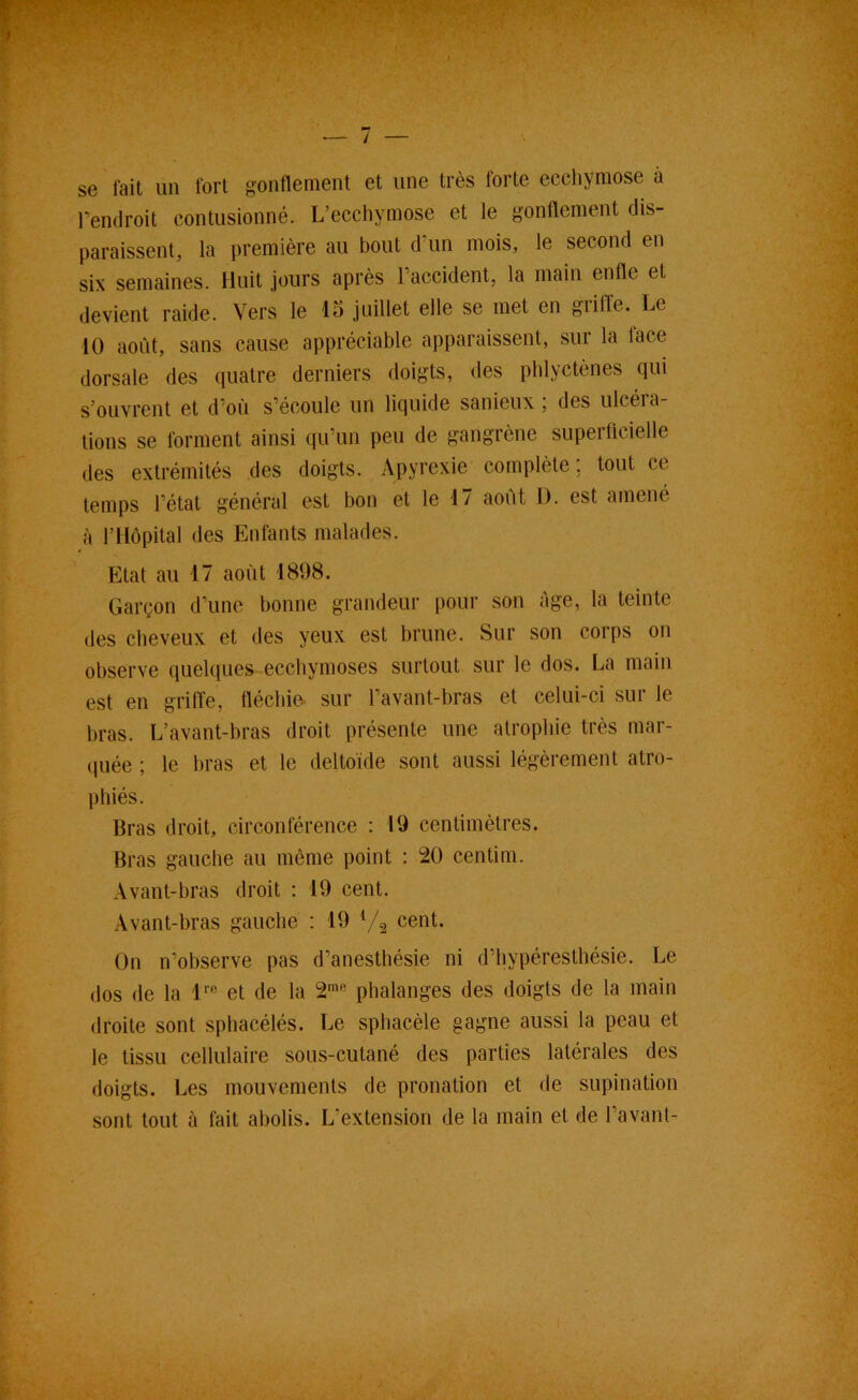 — / se fait un fort gonflement et une très forte eccliymose à l’endroit contusionné. L’ecchymose et le gonflement dis- paraissent, la première au bout d’un mois, le second en six semaines. Huit jours après l’accident, la main enfle et devient raide. Vers le 15 juillet elle se met en grille. Le 10 août, sans cause appréciable apparaissent, sur la lace dorsale des quatre derniers doigts, des phlyctènes qui s’ouvrent et d’où s’écoule un liquide sanieux ; des ulcéra- tions se forment ainsi qu’un peu de gangrène superflcielle des extrémités des doigts. Apyrexie complète ; tout ce temps l’état général est bon et le 17 août D. est amené à l’Hôpital des Enfants malades. Etat au 17 août 1808. Garçon d’une bonne grandeur pour son ôge, la teinte des cheveux et des yeux est brune. Sur son corps on observe quelques ecchymoses surtout sur le dos. La main est en grille, fléchie, sur l’avant-bras et celui-ci sur le bras. L’avant-bras droit présente une atrophie très mar- (luée ; le bras et le deltoïde sont aussi légèrement atro- phiés. Bras droit, circonférence : 19 centimètres. Bras gauche au même point : 20 centim. Avant-bras droit : 19 cent. Avant-bras gauche : 10 Vg cent. On n’observe pas d’anesthésie ni d’bypéresthésie. Le dos de la l’’® et de la 2'® phalanges des doigts de la main droite sont sphacélés. Le sphacèle gagne aussi la peau et le tissu cellulaire sous-cutané des parties latérales des doigts. Les mouvements de pronation et de supination sont tout à fait abolis. L’extension de la main et de l’avant-