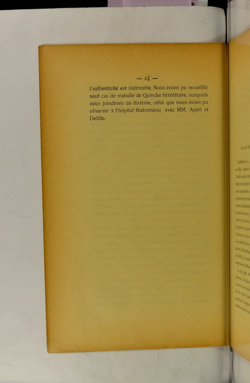 r — i4 — l’authenticité est indéniable. Nous avons pu recueillir neuf cas de maladie de Quincke héréditaire, auxquels nous joindrons un dixième, celui que nous avons pu observer à l’hôpital Bretonneau .avec MM. Apert et Delille.