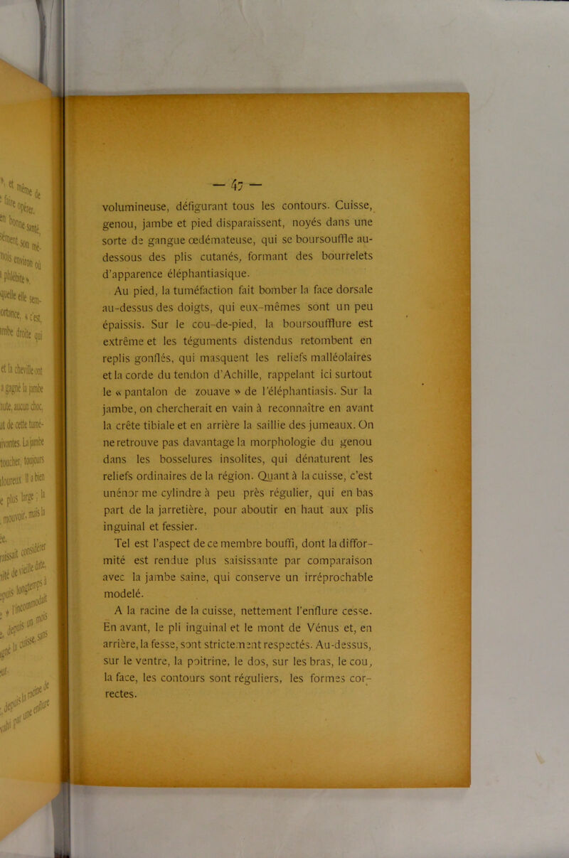 volumineuse, défigurant tous les contours. Cuisse, genou, jambe et pied disparaissent, noyés dans une sorte de gangue œdémateuse, qui se boursouffle au- dessous des plis cutanés, formant des bourrelets d’apparence éléphantiasique. Au pied, la tuméfaction fait bomber la face dorsale au-dessus des doigts, qui eux-mêmes sont un peu épaissis. Sur le cou-de-pied, la boursoufflure est extrême et les téguments distendus retombent en replis gonflés, qui masquent les reliefs malléolaires et la corde du tendon d’Achille, rappelant ici surtout le « pantalon de zouave » de l’éléphantiasis. Sur la jambe, on chercherait en vain à reconnaître en avant la crête tibiale et en arrière la saillie des jumeaux. On ne retrouve pas davantage la morphologie du genou dans les bosselures insolites, qui dénaturent les reliefs ordinaires delà région. Quant à la cuisse, c’est Linénor me cylindre à peu près régulier, qui en bas part de la jarretière, pour aboutir en haut aux plis inguinal et fessier. Tel est l’aspect de ce membre bouffi, dont la diffor- mité est rendue plus saisissante par comparaison avec la jambe saine, qui conserve un irréprochable modelé. A la racine de la cuisse, nettement l’enflure cesse. En avant, le pli inguinal et le mont de Vénus et, en arrière, la fesse, sont strictement respectés. Au-dessus, sur le ventre, la poitrine, le dos, sur les bras, le cou, la face, les contours sont réguliers, les formes cor- rectes.