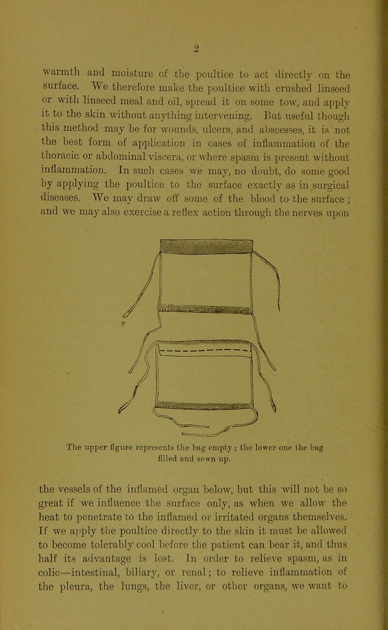 warmth and moisture of the poultice to act directly on the surface. We therefore make the poultice with crushed linseed or with linseed meal and oil, spread it on some tow, and apply it to the skin without anything intervening. But useful though this method may he for wounds, ulcers, and abscesses, it is not the best form of application in cases of inflammation of the thoracic or abdominal viscera, or where spasm is present without inflammation. In such cases we may, no doubt, do some good by applying the poultice to the surface exactly as in surgical diseases. We may draw off some of the blood to the surface ; and we may also exercise a reflex action through the nerves upon Tlie upper figure represents the hag empty; the lower one the bag filled and sewn up. the vessels of the inflamed organ below, but this will not be so great if we influence the surface only, as when we allow the heat to penetrate to the inflamed or irritated organs themselves. If we apply the poultice directly to the skin it must be allowed to become tolerably cool before the patient can bear it, and thus half its advantage is lost. In order to relieve spasm, as in colic—intestinal, biliary, or renal; to relieve inflammation of the pleura, the lungs, the liver, or other organs, we want to