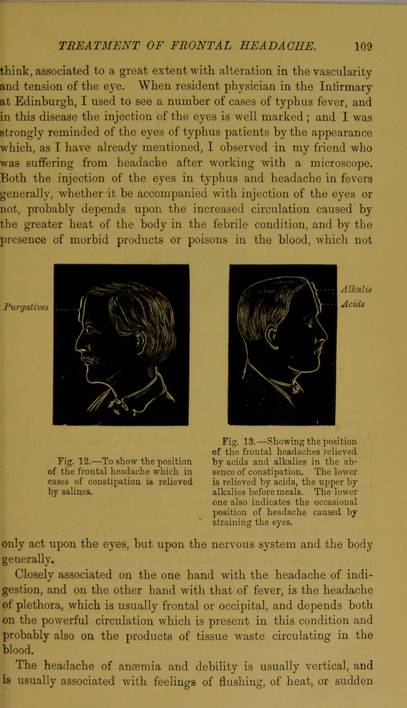 think, associated to a great extent with alteration in the vascularity and tension of the eye. When resident physician in the Infirmary at Edinburgh, I used to see a number of cases of typhus fever, and in this disease the injection of the eyes is well marked ; and I was strongly reminded of the eyes of typhus patients by the appearance which, as I have already mentioned, I observed in my friend who was suffering from headache after working with a microscope. Both the injection of the eyes in typhus and headache in fevers generally, whether it be accompanied with injection of the eyes or not, probably depends upon the increased circulation caused by the greater heat of the body in the febrile condition, and by the presence of morbid products or poisons in the blood, which not Purgatives Alkalis Acids Fig. 12.—To show the position of the frontal headache which in cases of constipation is relieved by salines. Fig. 13.—Showing the position of the frontal headaches relieved by acids and alkalies in the ab- sence of constipation. The lower is relieved by acids, the upper by alkalies before meals. The lower one also indicates the occasional position of headache caused by straining the eyes. only act upon the eyes, but upon the nervous system and the body generally. Closely associated on the one hand with the headache of indi- gestion, and on the other hand with that of fever, is the headache of plethora, which is usually frontal or occipital, and depends both on the powerful circulation which is present in this condition and probably also on the products of tissue waste circulating in the blood. The headache of anaemia and debility is usually vertical, and is usually associated with feelings of flushing, of heat, or sudden