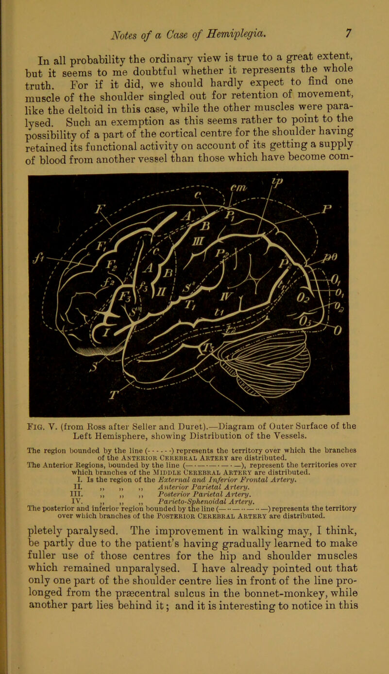 In all probability the ordinary view is true to a great extent, but it seems to me doubtful whether it represents the whole truth. For if it did, we should hardly expect to find one muscle of the shoulder singled out for retention of movement, like the deltoid in this case, while the other muscles were para- lysed. Such an exemption as this seems rather to point to the possibility of a part of the cortical centre for the shoulder having retained its functional activity on account of its getting a supply of blood from another vessel than those which have become com- Fig. V. (from Boss after Seller and Duret).—Diagram of Outer Surface of the Left Hemisphere, showing Distribution of the Vessels. The region bounded by the line ( ) represents the territory over which the branches of the Anterior Cerebral Artery are distributed. The Anterior Regions, bounded by the line ( ), represent the territories over which branches of the Middle Cerebral Artery are distributed. I. Is the region of the External and Ivjerior Frontal Artery. II. ,, ,, ,, Anterior Parietal Artery. III. ,, ,, ,, Posterior Parietal Artery. IV. ,, „ „ Parieto-Sphenoidal Artery. The posterior and inferior region bounded by the line ( ) represents the territory over which branches of the Posterior Cerebral Artery are distributed. pletely paralysed. The improvement in walking may, I think, be partly due to the patient’s having gradually learned to make fuller use of those centres for the hip and shoulder muscles which remained unparalysed. I have already pointed out that only one part of the shoulder centre lies in front of the line pro- longed from the praecentral sulcus in the bonnet-monkey, while another part lies behind it; and it is interesting to notice in this
