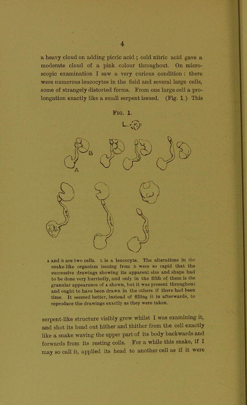 a heavy cloud on adding picric acid ; cold nitric acid gave a moderate cloud of a pink colour throughout. On micro- scopic examination I saw a very curious condition : there were numerous leucocytes in the field and several large cells, some of strangely distorted forms. From one large cell a pro- longation exactly like a small serpent issued. (Fig. 1.) This a and B are two cells. L is a leucocyte. The alterations in the snake like organism issuing from B were so rapid that the successive drawings showing its apparent size and shape had to be done very hurriedly, and only in the fifth of them is the granular appearance of a shown, but it was present throughout and ought to have been drawn in the others if there had been time. It seemed better, instead of filling it in afterwards, to reproduce the drawings exactly as they were taken. serpent-like structure visibly grew whilst I was examining it, and shot its head out hither and thither from the cell exactly like a snake waving the upper part of its body backwards and forwards from its resting coils. For a while this snake, if I may so call it, applied its head to another cell as if it were Fig. 1.